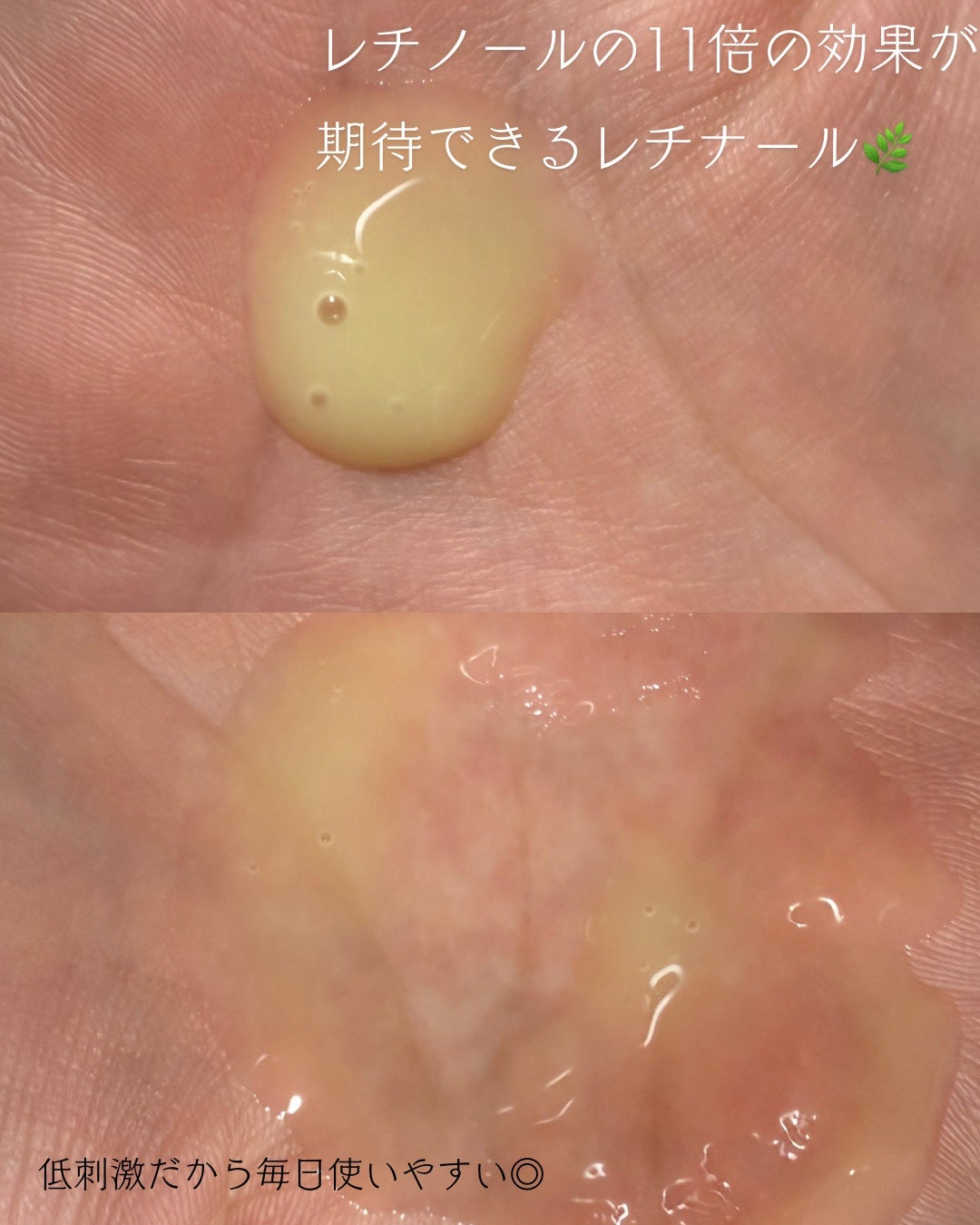 レチナールスキンブースターセラム15mL/MEDITHERAPY/ブースター・導入液を使ったクチコミ(3枚目)