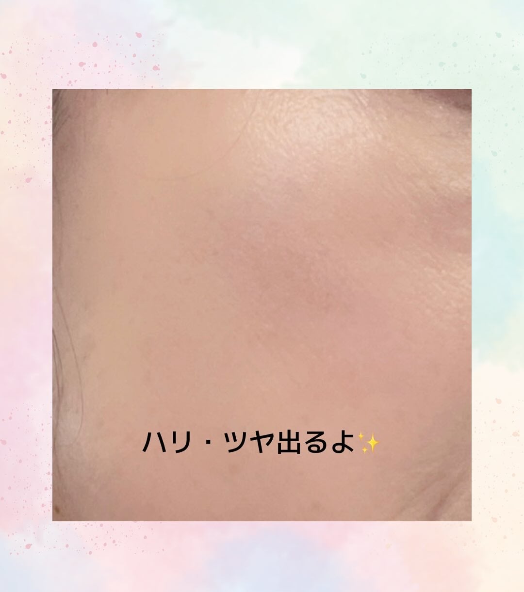 NMNブリリアントセラム/Alegría/美容液を使ったクチコミ(4枚目)