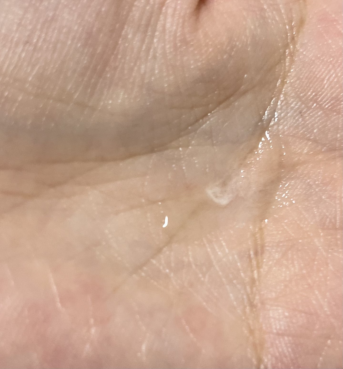 アセット スカルプエッセンス リッチスプリング/DEMI DO/頭皮ローションを使ったクチコミ（2枚目）