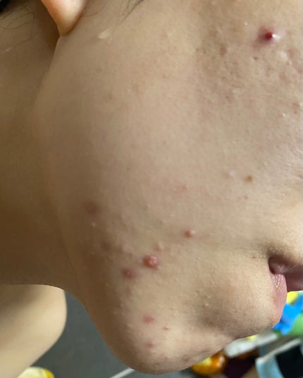 を使ったクチコミ(3枚目)