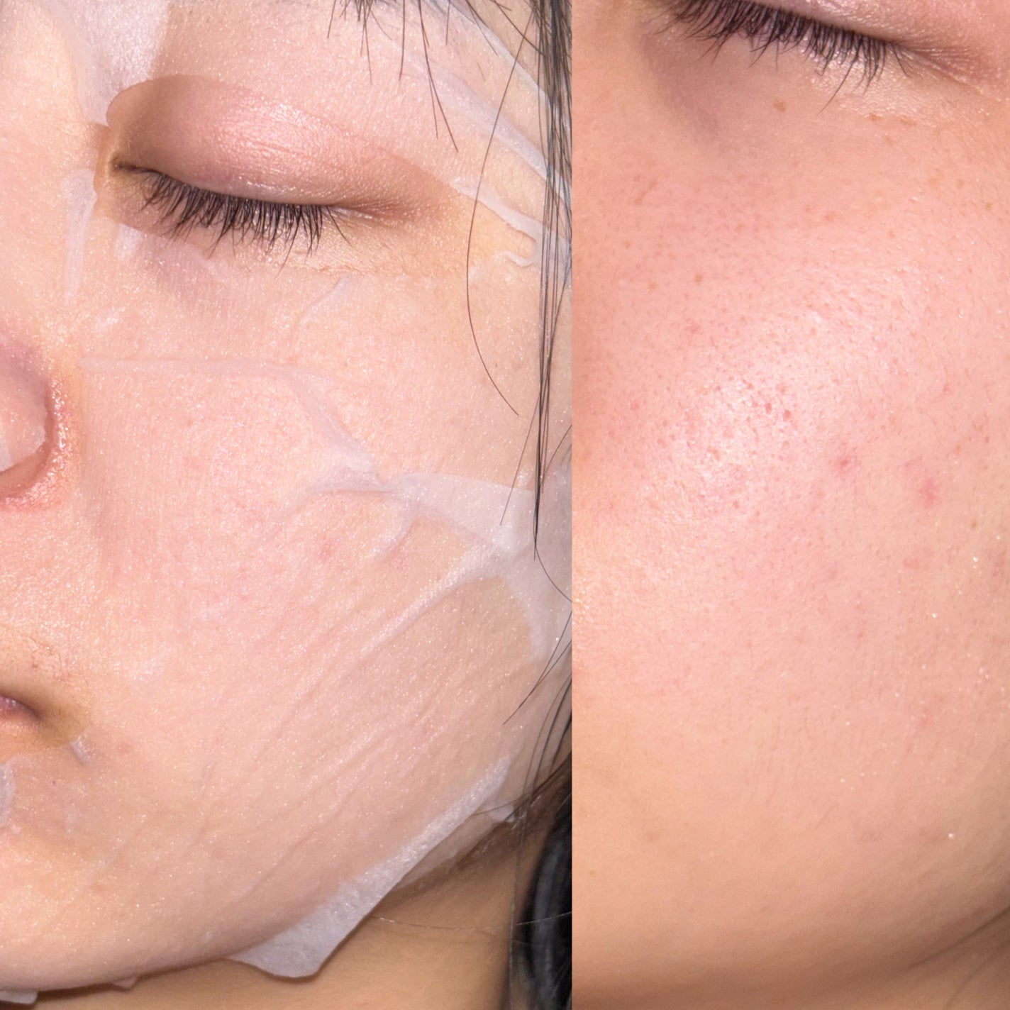 マデカソサイド ブレミッシュパッド/MEDIHEAL/トナーパッドを使ったクチコミ(4枚目)