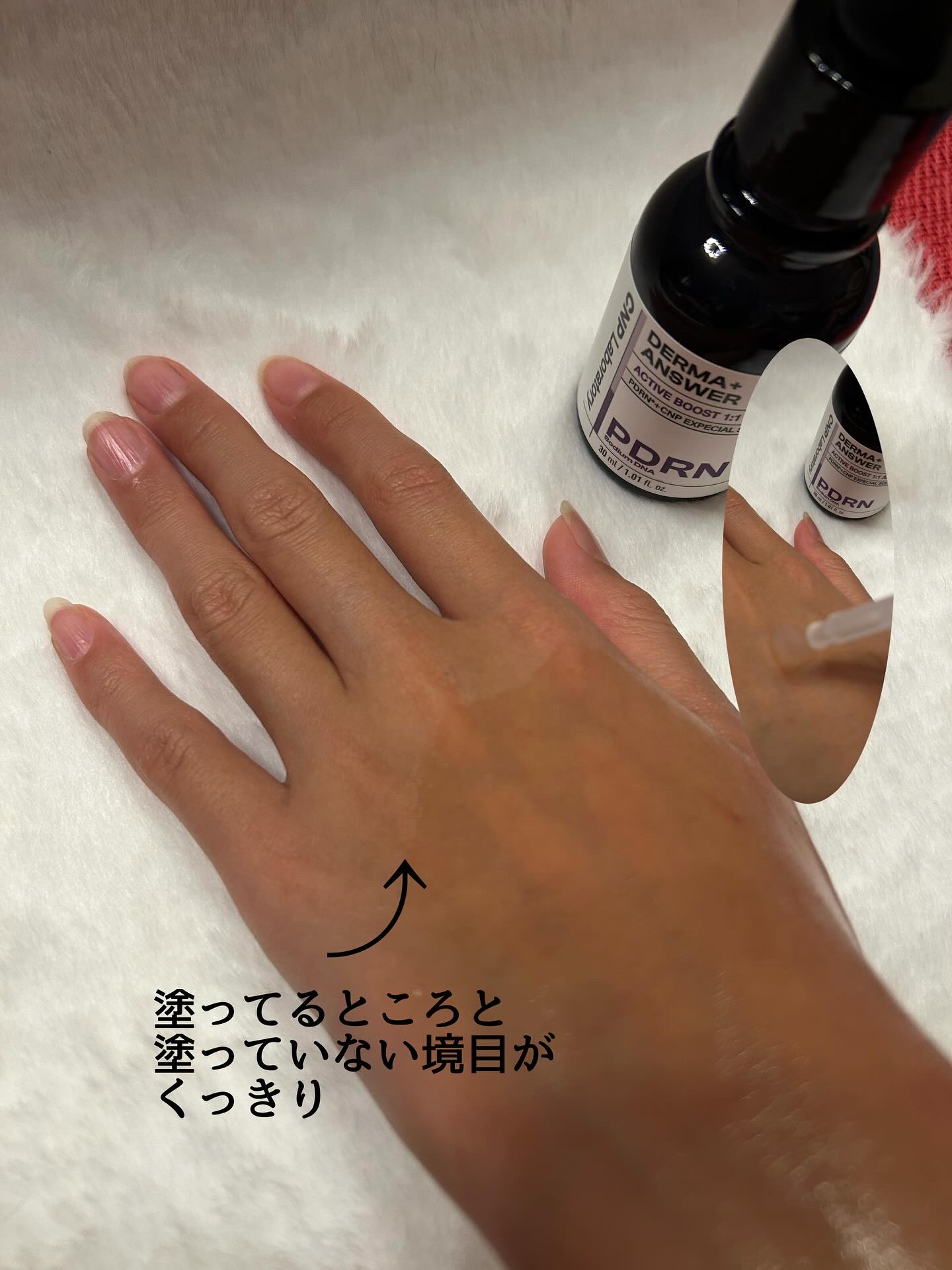 ダーマアンサー PDRN アクティブブースト1:1アンプル/CNP Laboratory/美容液を使ったクチコミ（3枚目）