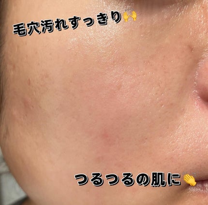 グリーントマトクレイマスククレンザー/FULLY/洗い流すパック・マスクを使ったクチコミ(5枚目)