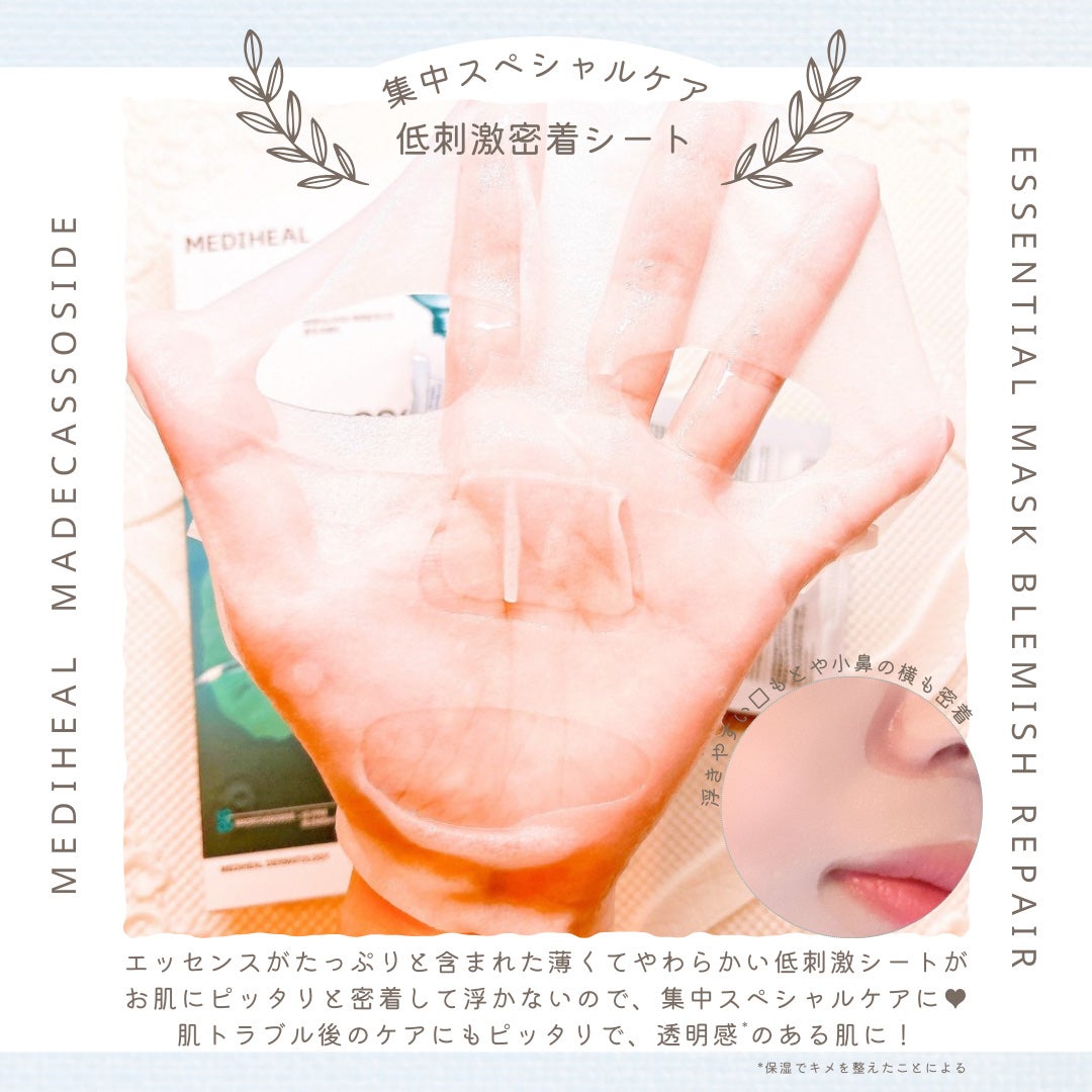 マデカッソシド エッセンシャルマスク/MEDIHEAL/シートマスク・パックを使ったクチコミ(4枚目)