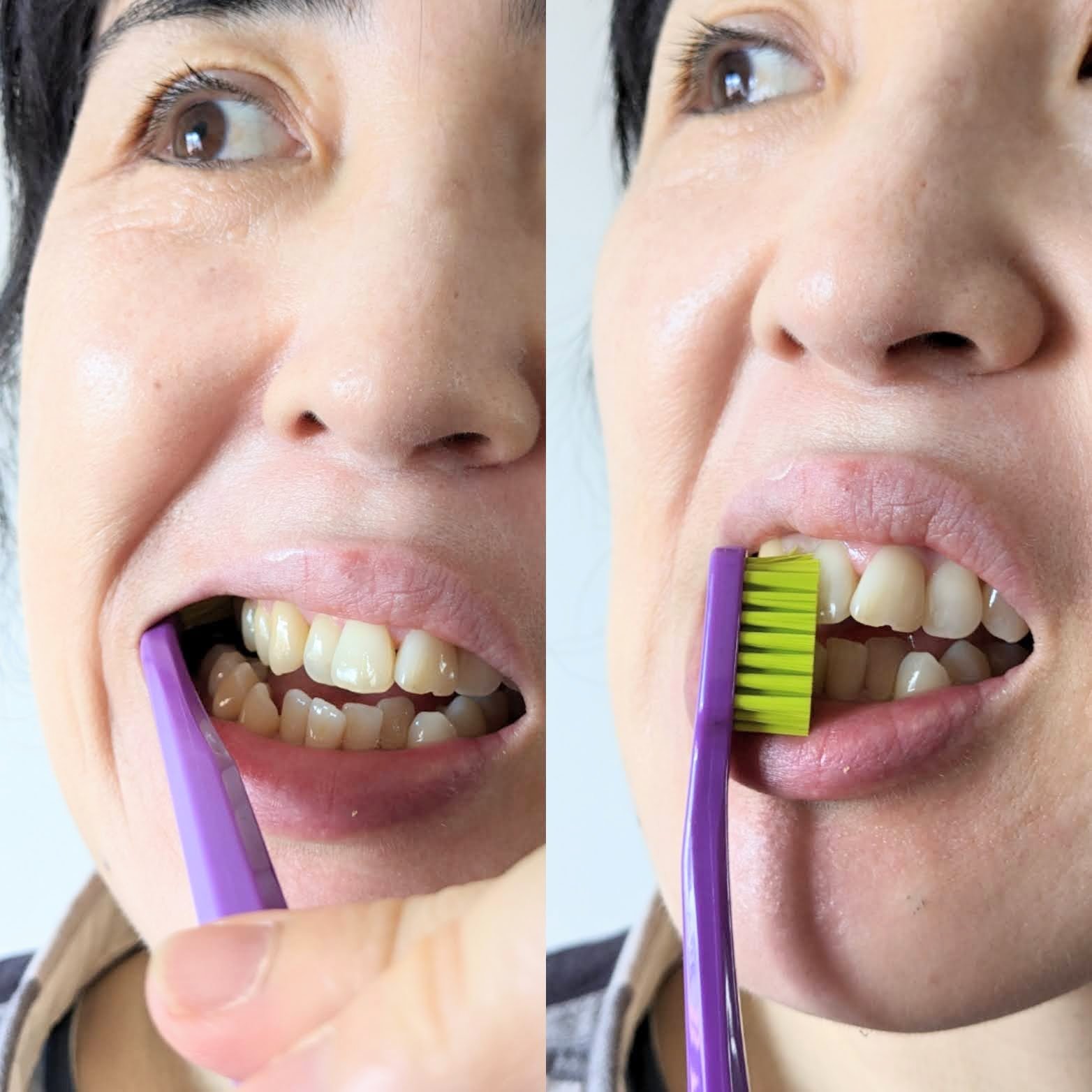 CURAPROX   CS 5460/CURAPROX/歯ブラシを使ったクチコミ（2枚目）