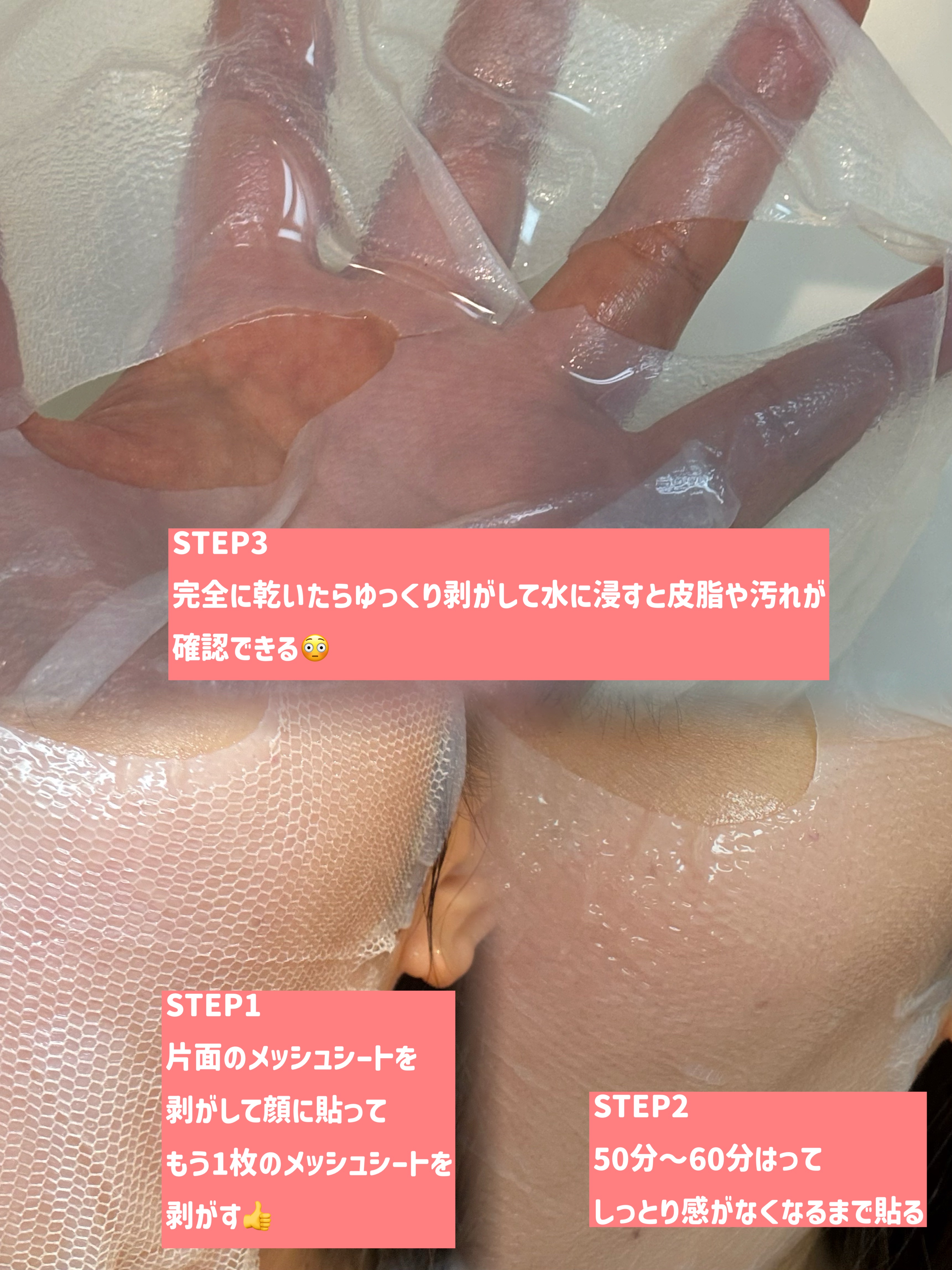 トラブルパッチマスク/EIOM/その他スキンケアを使ったクチコミ（3枚目）