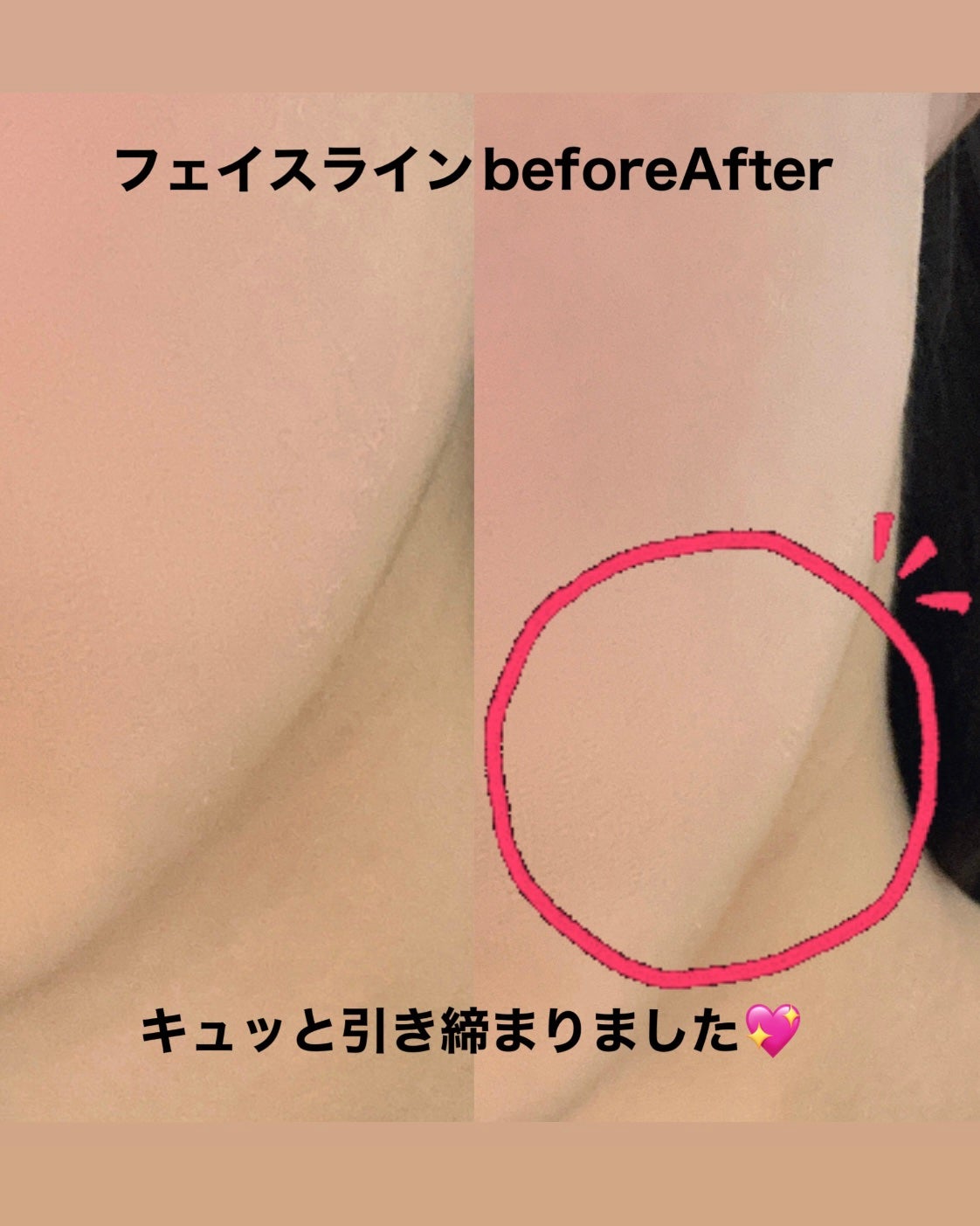 温冷リフトかっさ/ANLAN/美顔器・マッサージを使ったクチコミ(6枚目)