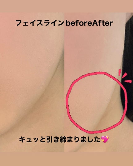 温冷リフトかっさ/ANLAN/美顔器・マッサージを使ったクチコミ(6枚目)