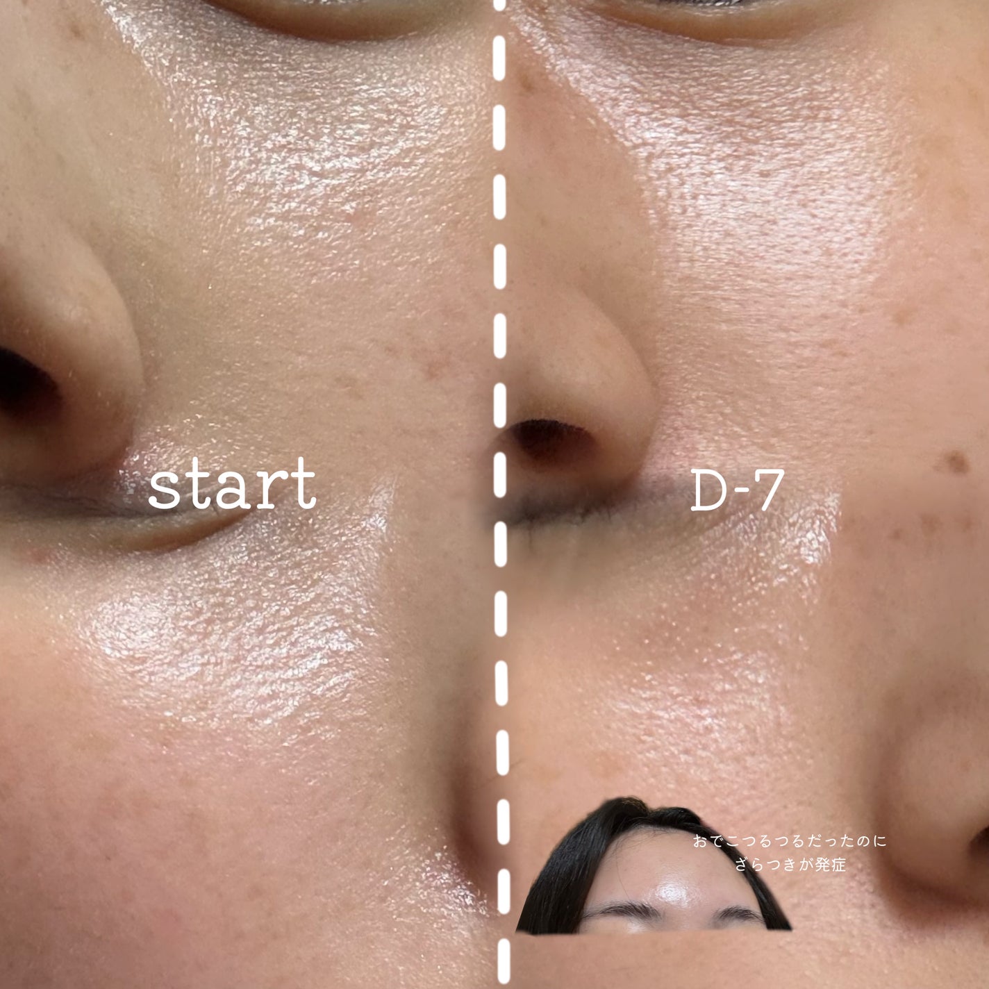 A1カーミング アンプル/VT/美容液を使ったクチコミ(5枚目)