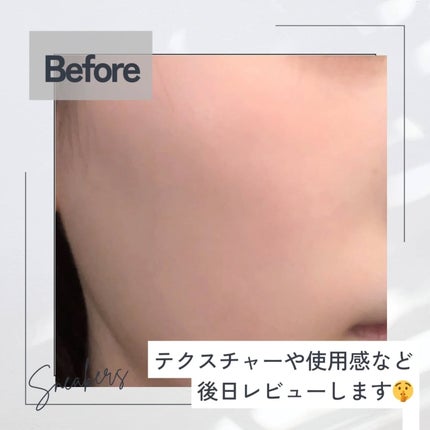 ダーマジェンシー ゼロカ81 セラム/DERMAGENCY/美容液を使ったクチコミ(4枚目)