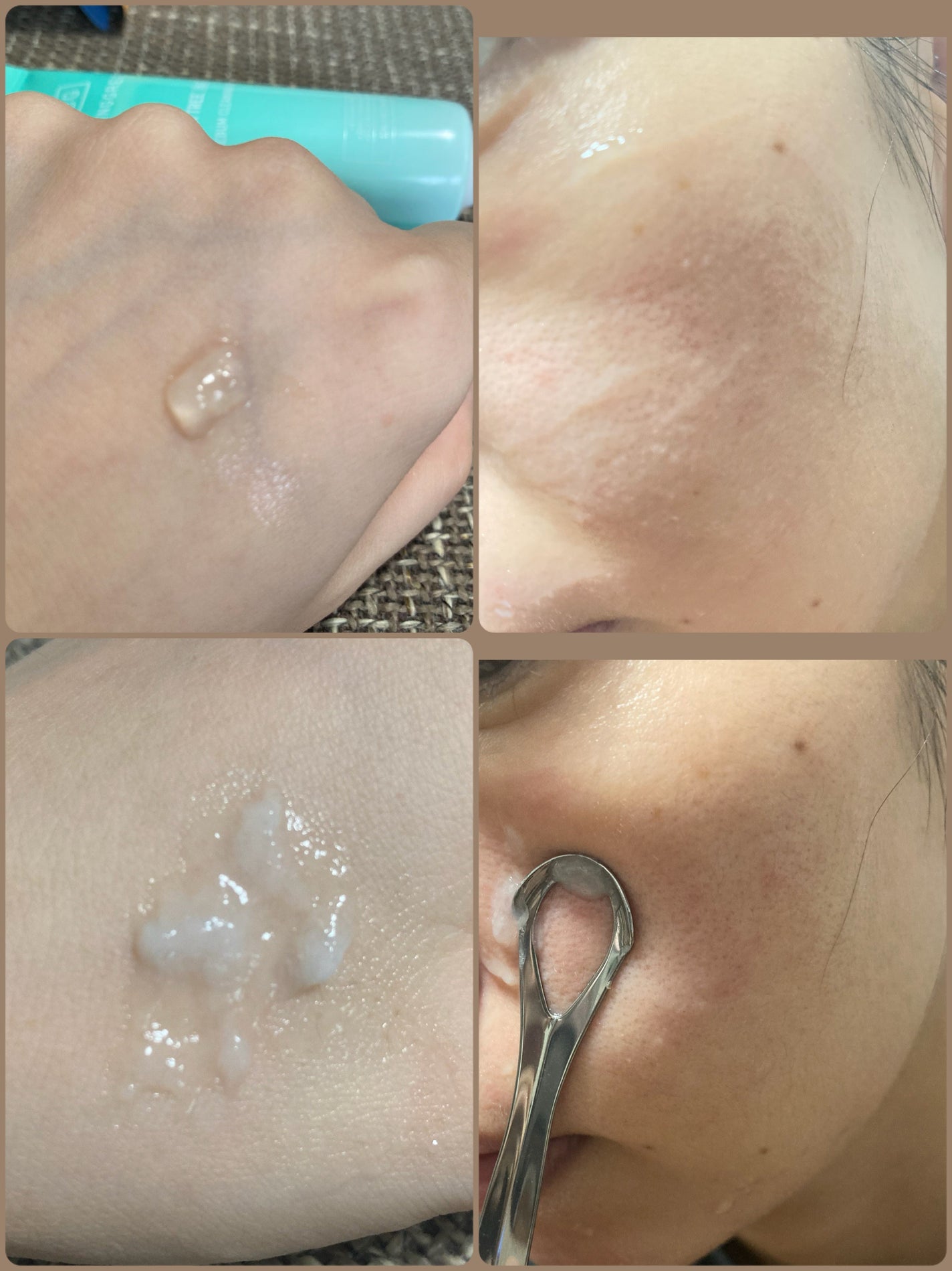 ティーツリーC皮脂クリーナー/BRING GREEN/その他スキンケアを使ったクチコミ(5枚目)