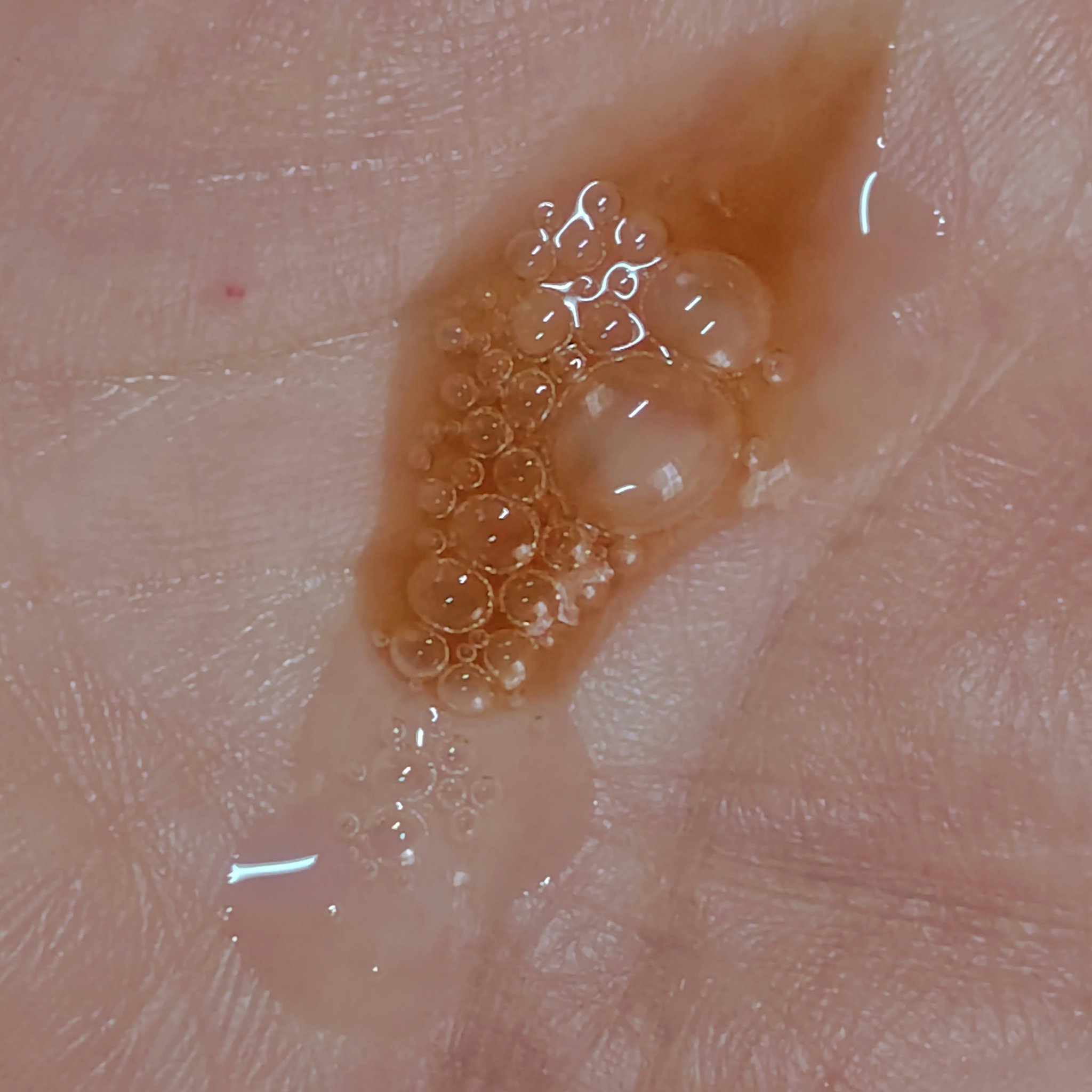 ダブル セーラム ADC/CLARINS/美容液を使ったクチコミ（3枚目）