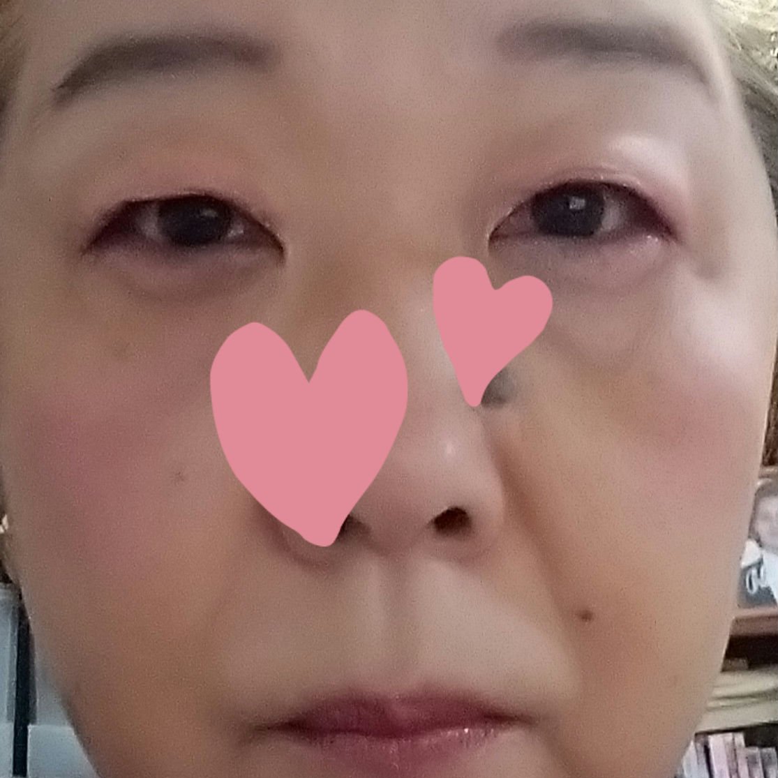 パウダーチークス/キャンメイク/パウダーチークを使ったクチコミ（3枚目）