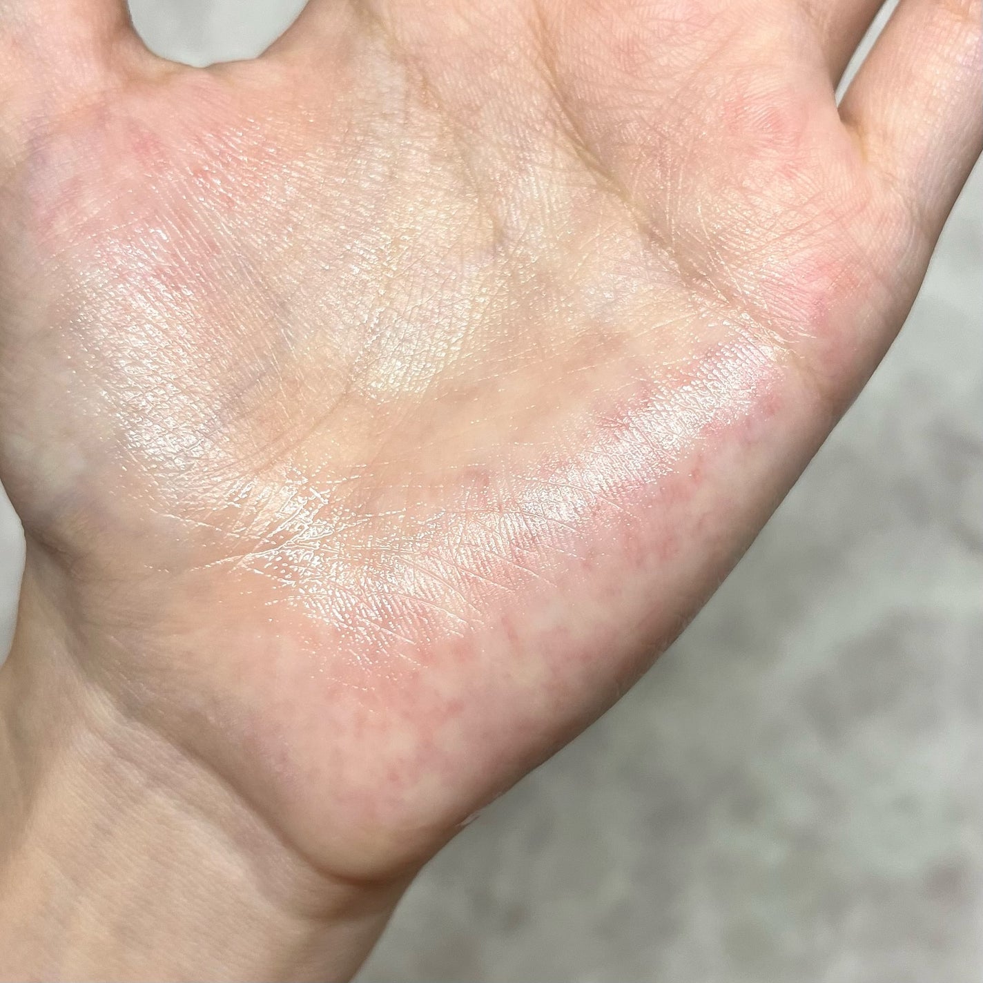 スネイル ソリューション エマルジョン/ネイチャーリパブリック/その他スキンケアを使ったクチコミ(4枚目)