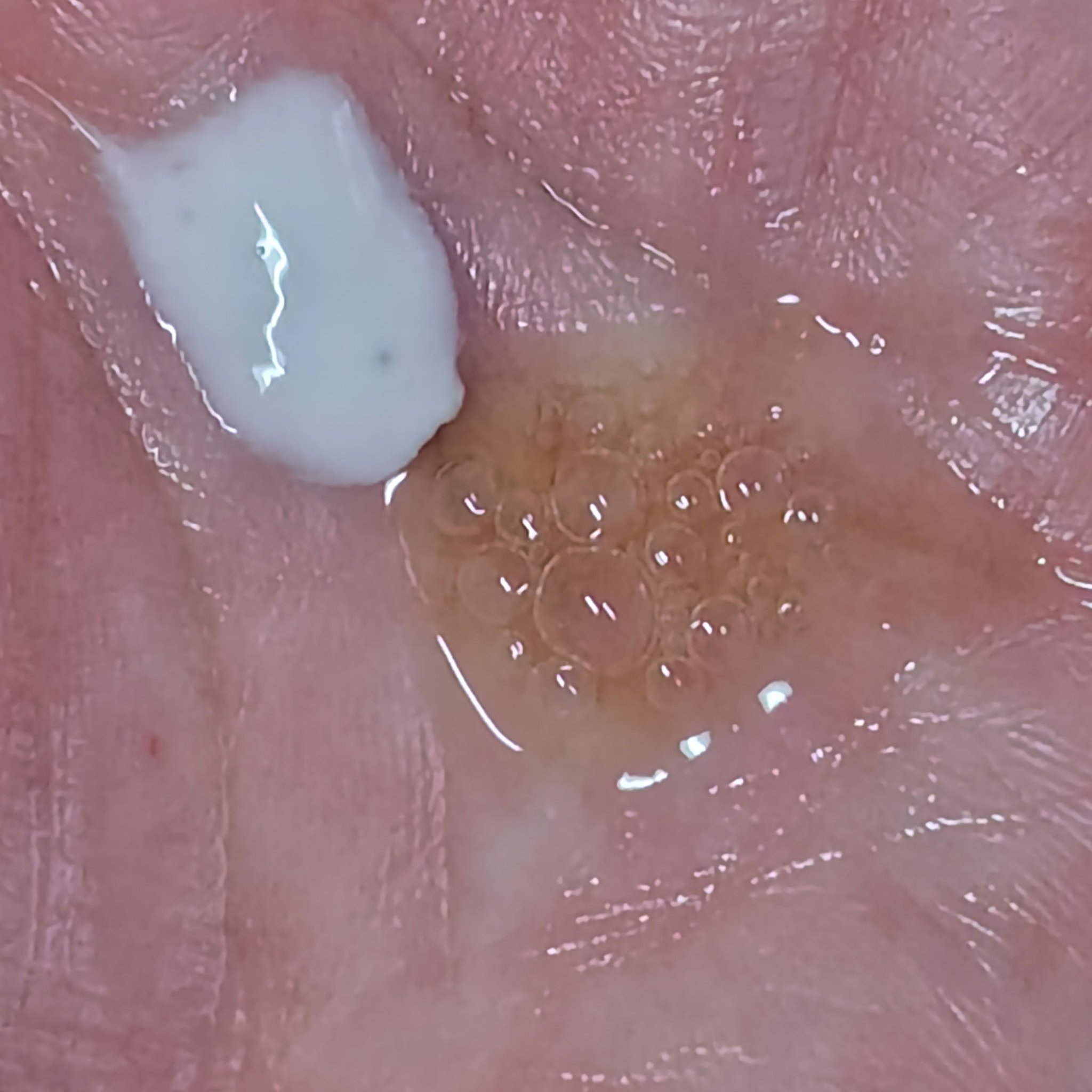 ダブル セーラム ADC/CLARINS/美容液を使ったクチコミ（3枚目）