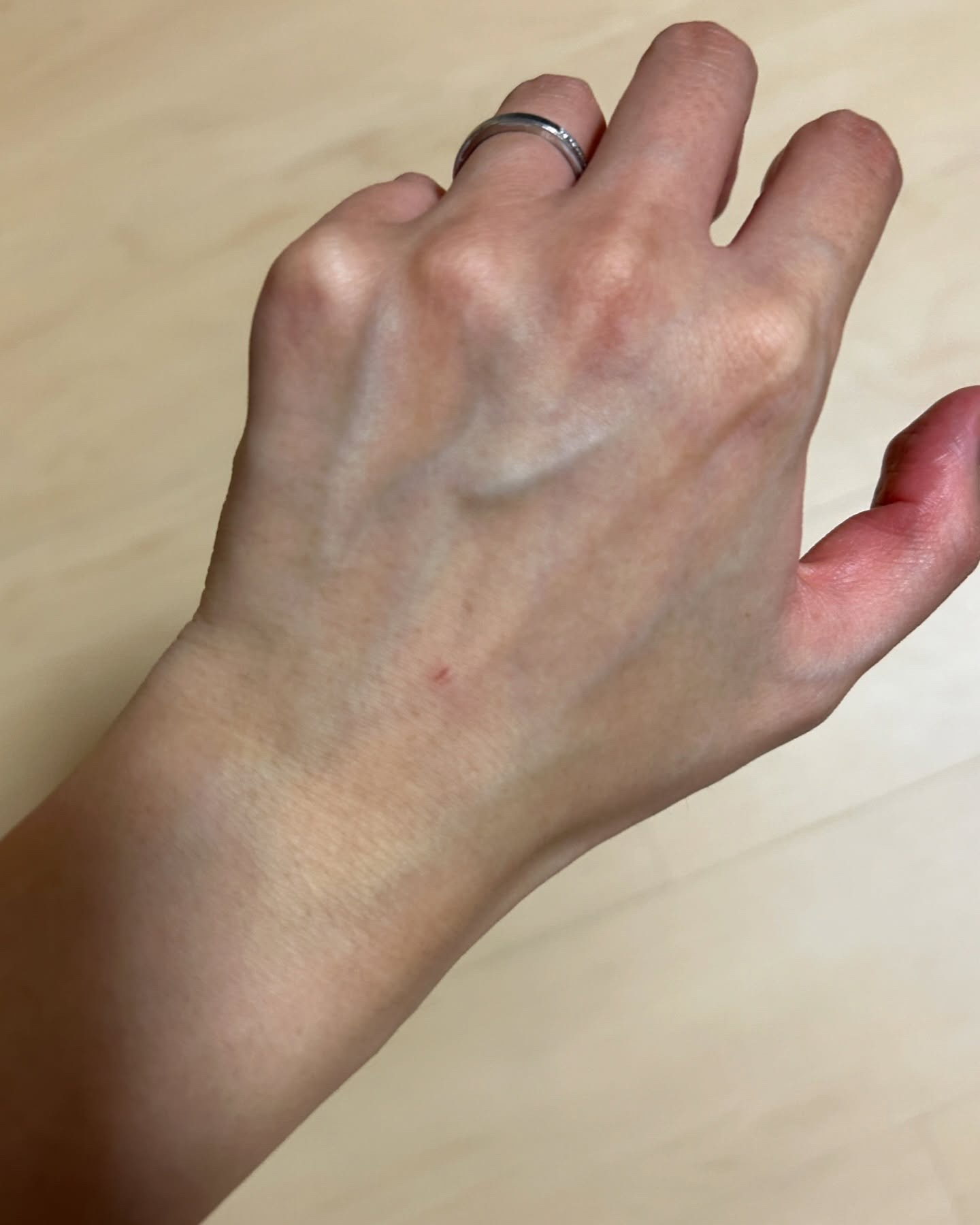 グリソメド ハンドクリーム A (ローズ)/グリソメド/ハンドクリームを使ったクチコミ（3枚目）