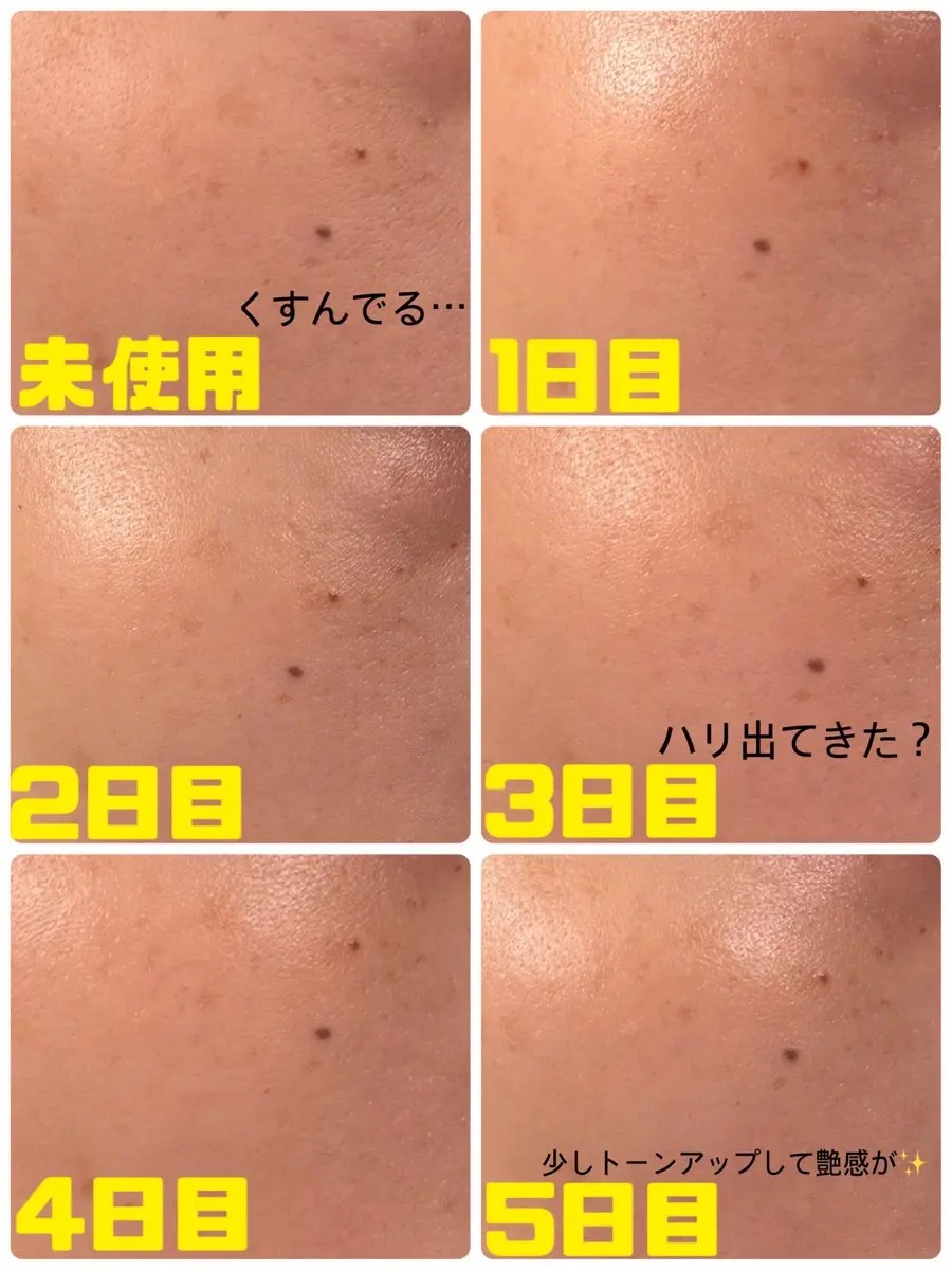 レチララ 美容液/ネイチャーリパブリック/美容液を使ったクチコミ（3枚目）