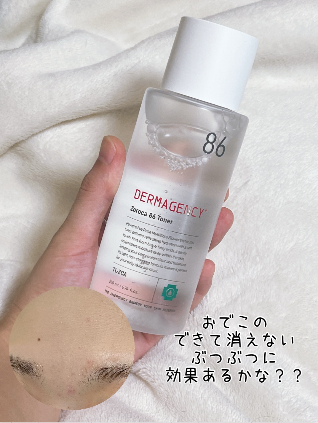 ダーマジェンシー ゼロカ86 トナー/DERMAGENCY/化粧水を使ったクチコミ（3枚目）