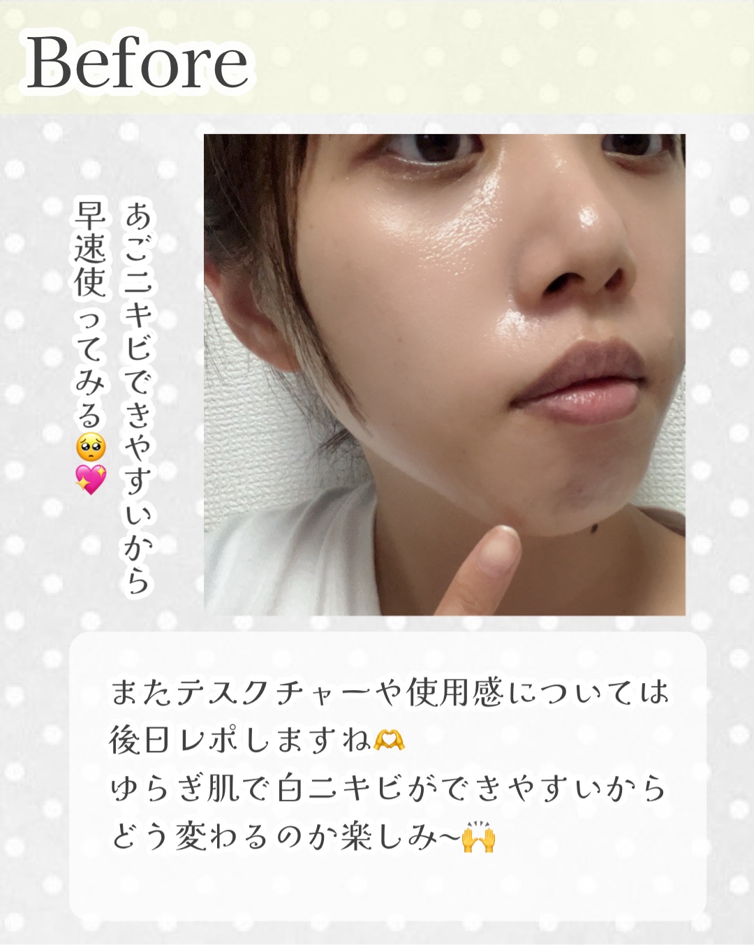 ダーマジェンシー ゼロカ86 トナー/DERMAGENCY/化粧水を使ったクチコミ（3枚目）