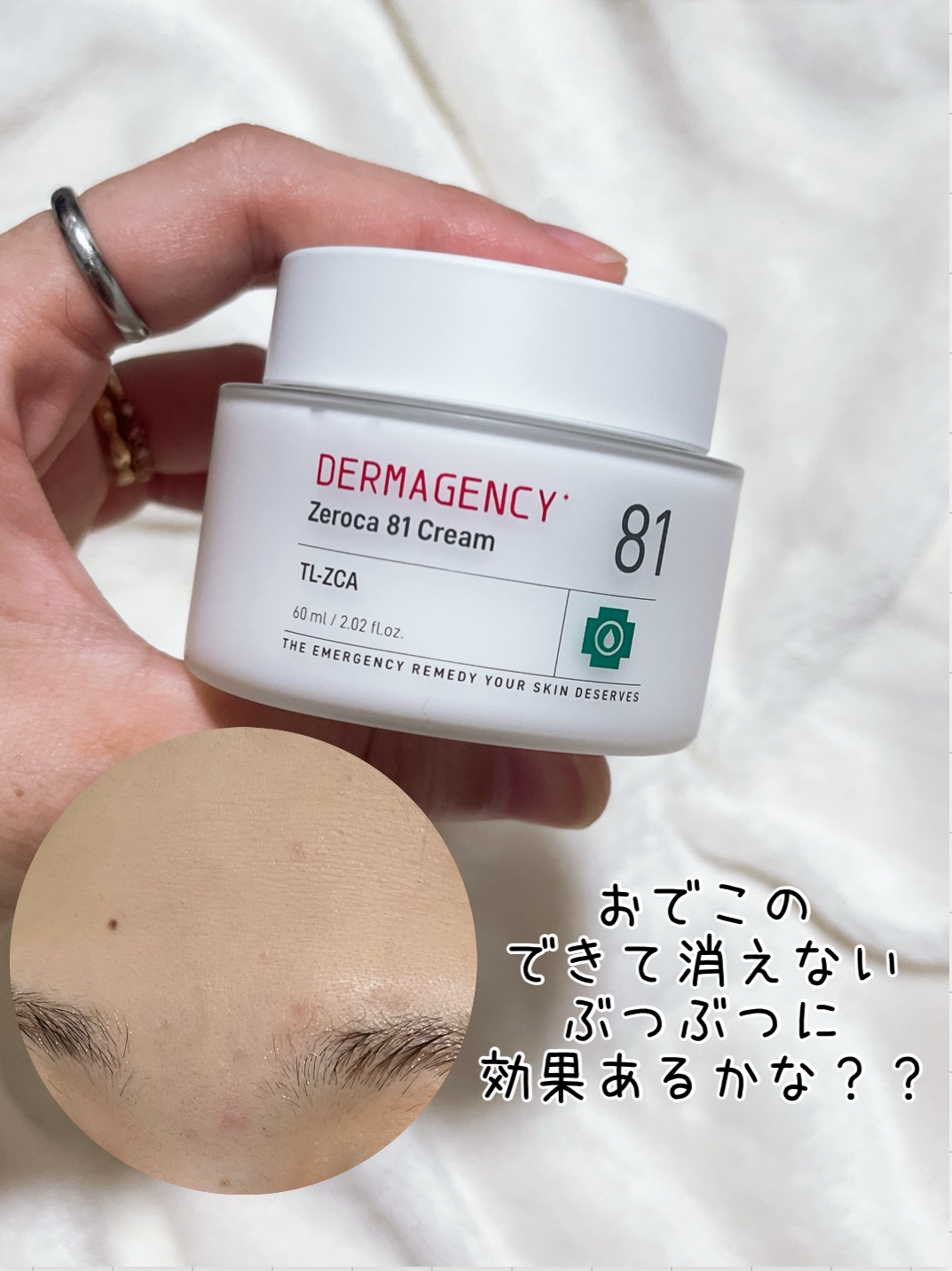 ダーマジェンシー ゼロカ81 クリーム/DERMAGENCY/フェイスクリームを使ったクチコミ（3枚目）