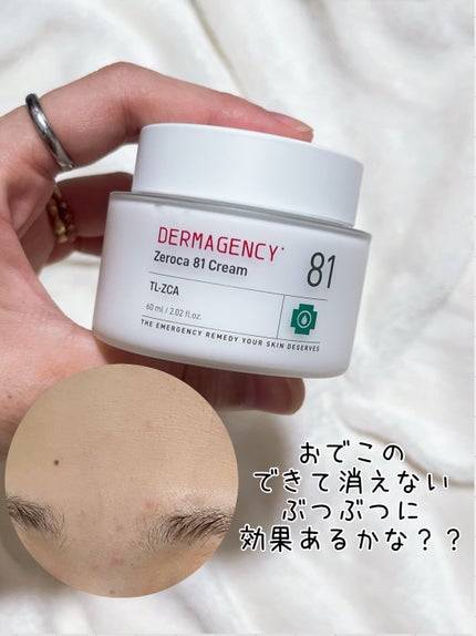 ダーマジェンシー ゼロカ81 クリーム/DERMAGENCY/フェイスクリームを使ったクチコミ(3枚目)