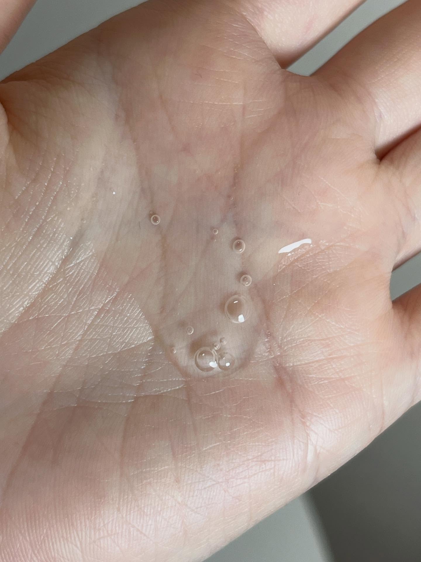 Zero spot ApN/Today’s Cosme/美容液を使ったクチコミ（3枚目）