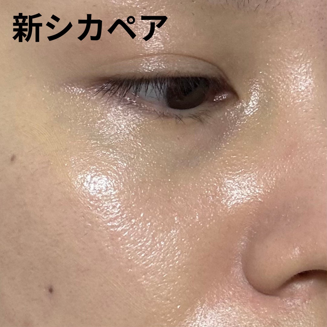 ドクタージャルト シカペア リカバー (第2世代)/Dr.Jart+/フェイスクリームを使ったクチコミ(4枚目)