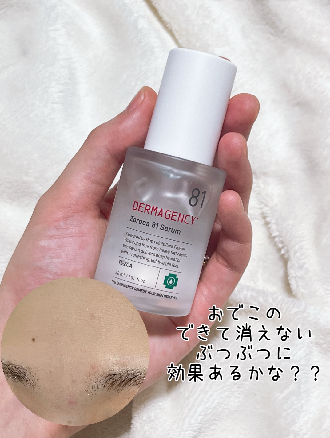 ダーマジェンシー ゼロカ81 セラム/DERMAGENCY/美容液を使ったクチコミ（3枚目）