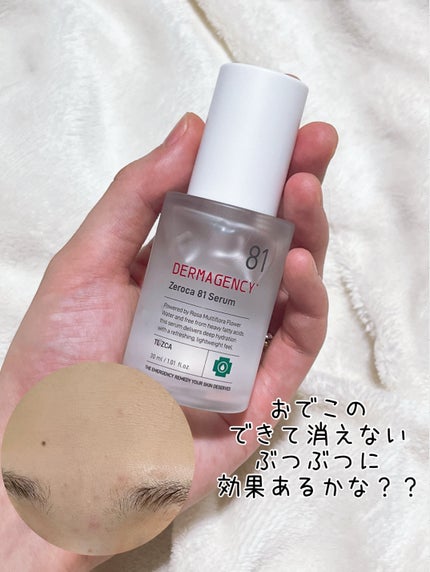 ダーマジェンシー ゼロカ81 セラム/DERMAGENCY/美容液を使ったクチコミ(3枚目)