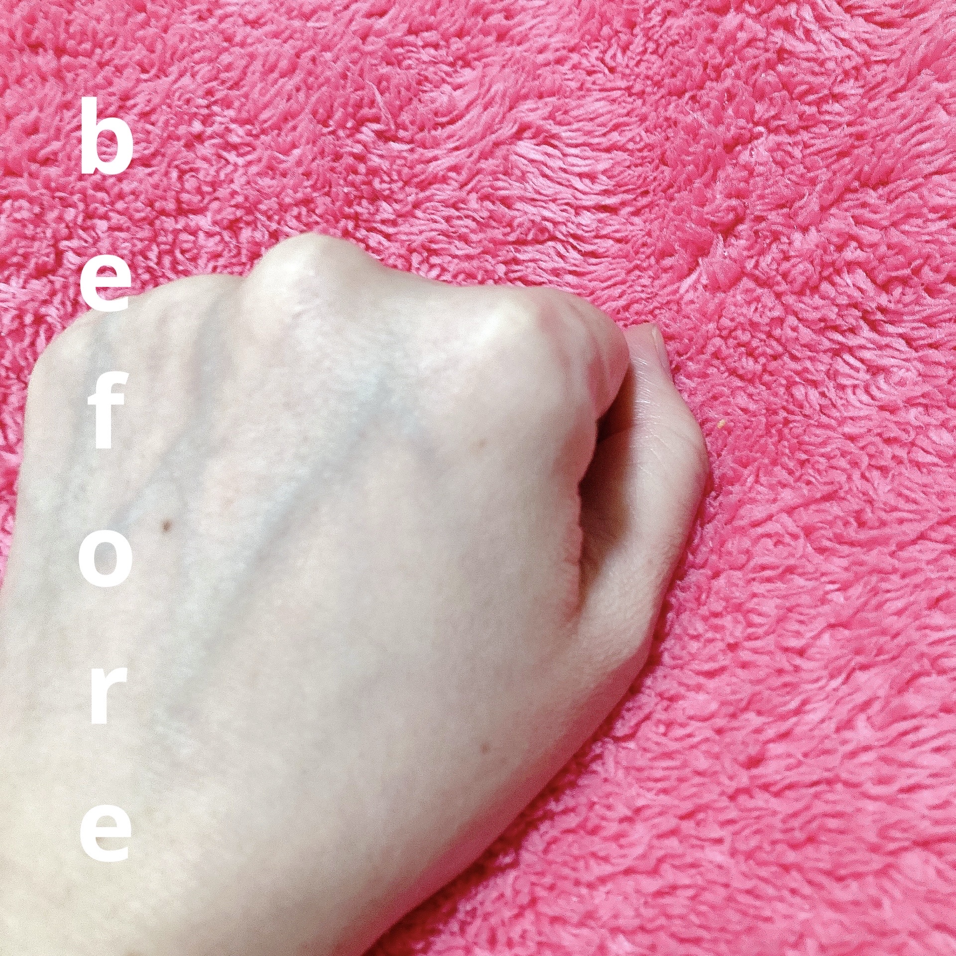 ダーマジェンシー ゼロカ86 トナー/DERMAGENCY/化粧水を使ったクチコミ（3枚目）