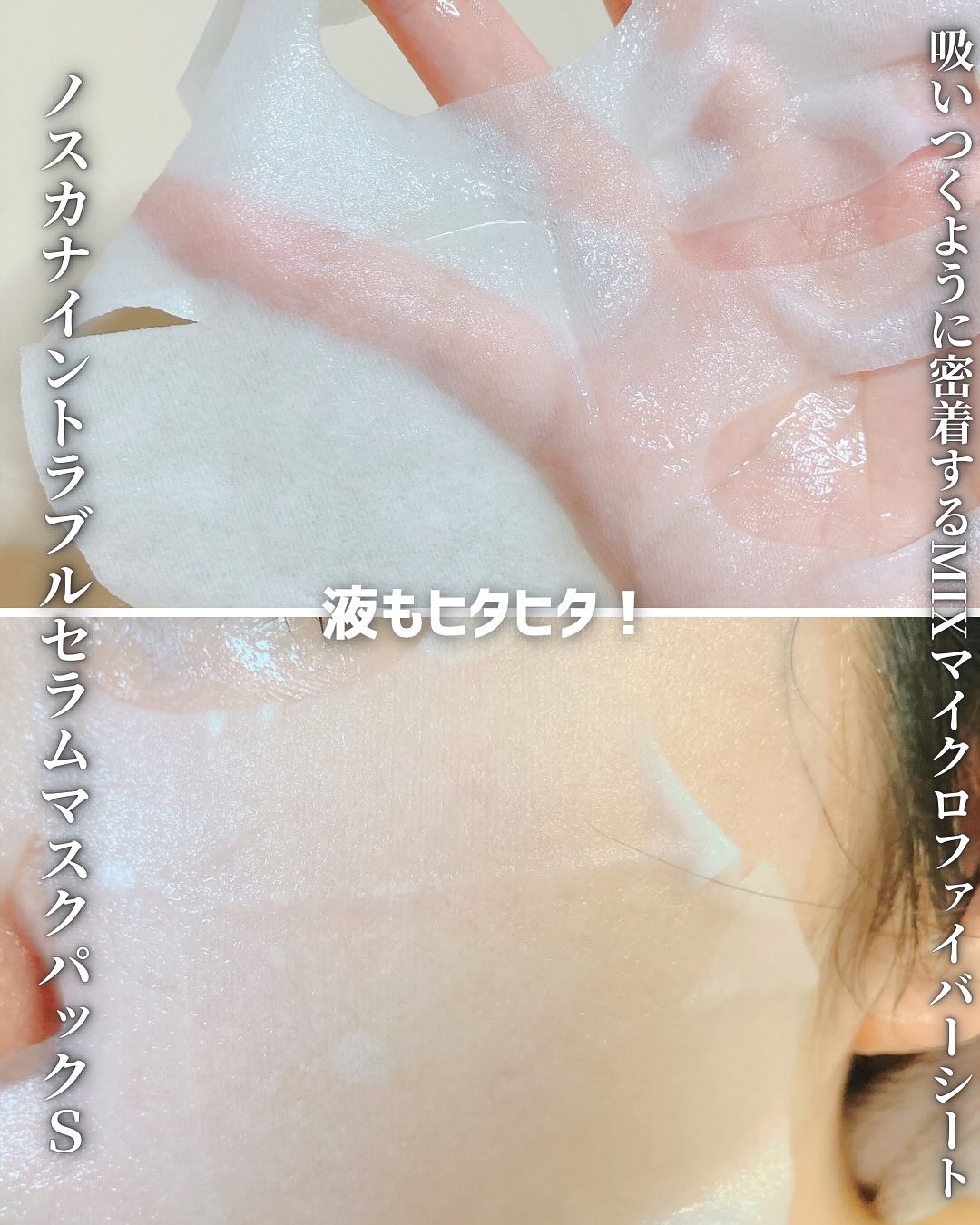 ノスカナイントラブルセラムS/FATION/美容液を使ったクチコミ（3枚目）