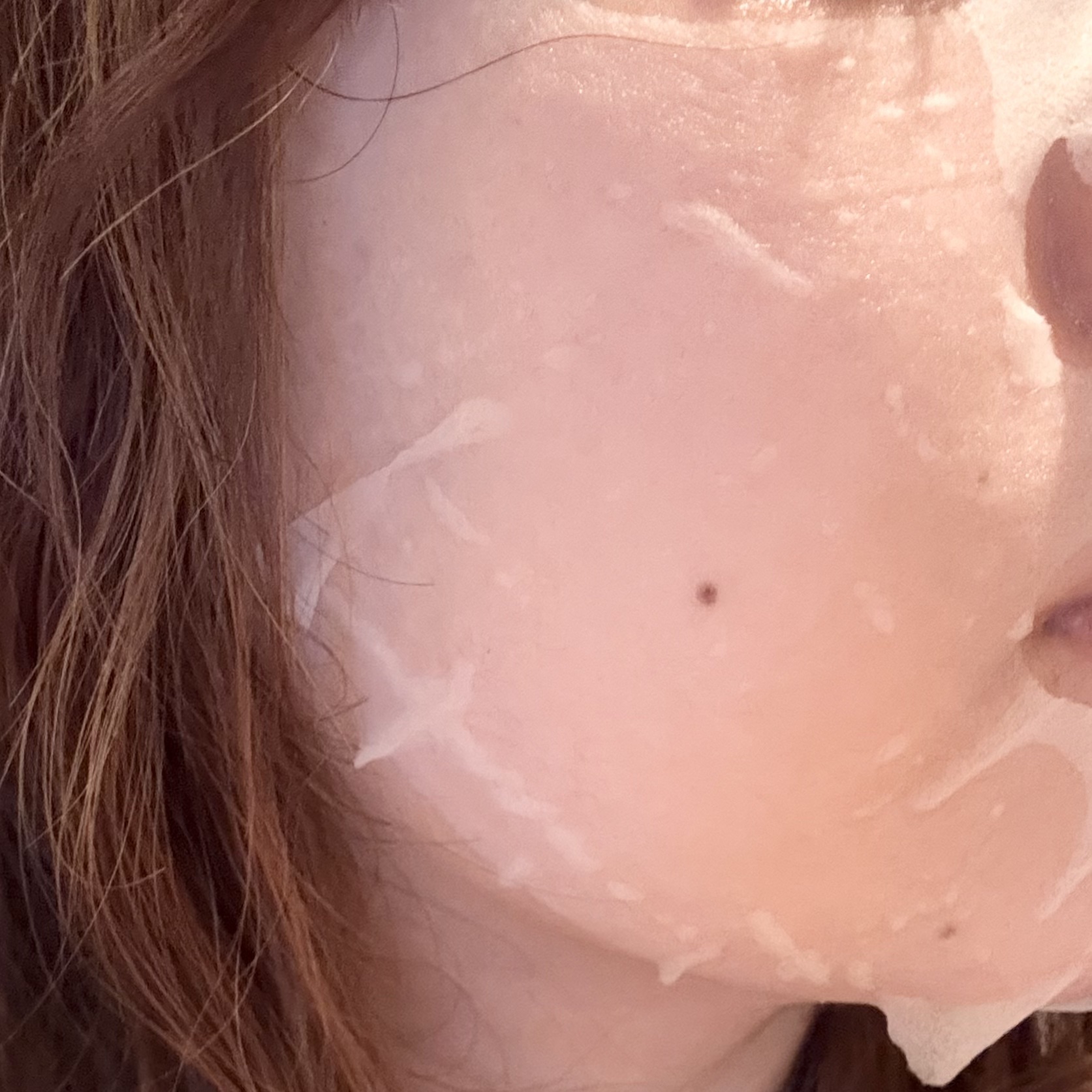 マデカッソシド ブレミッシュマスク/MEDIHEAL/シートマスク・パックを使ったクチコミ（2枚目）