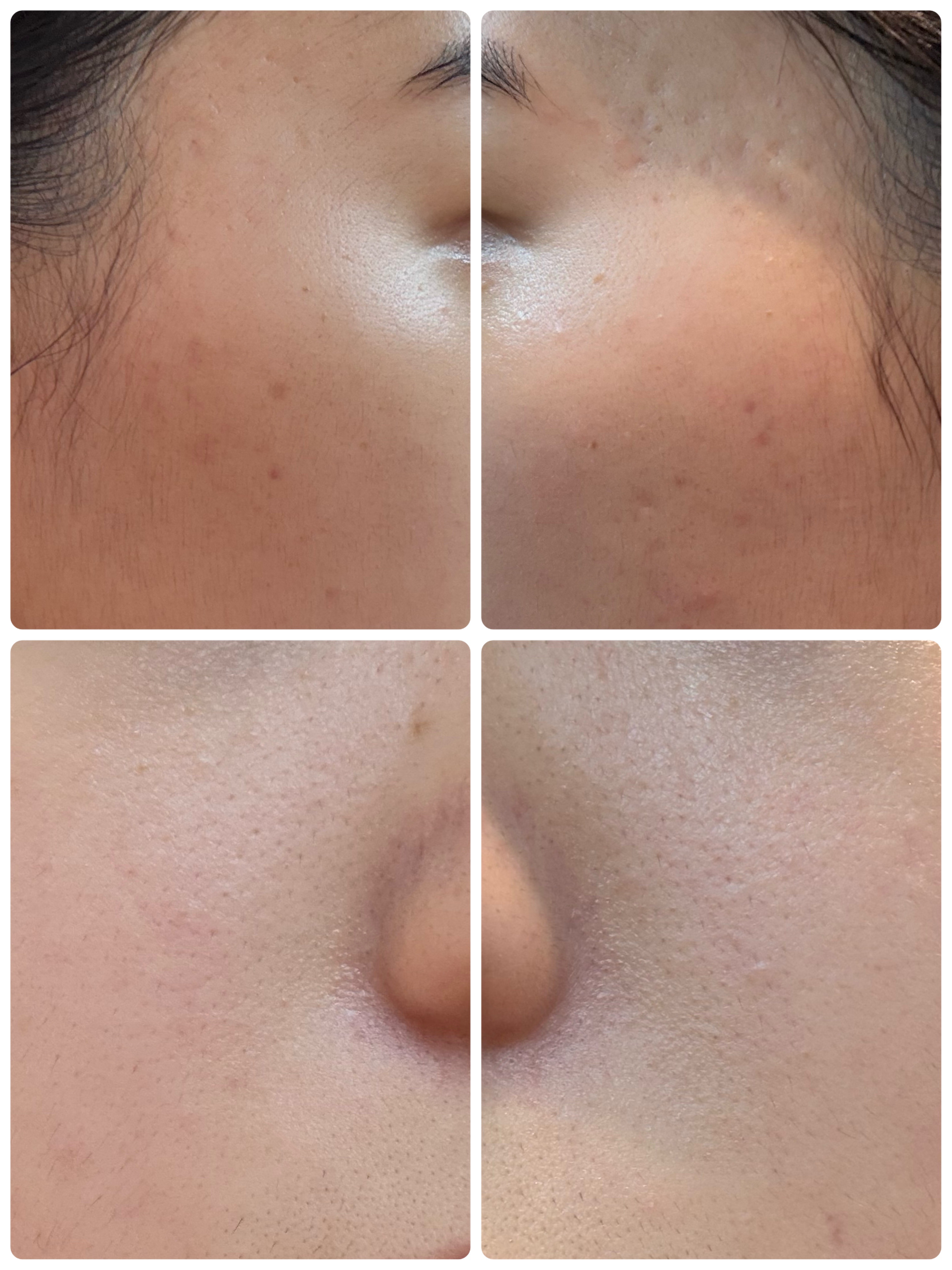 エターナルアイクリーム/リュバンブラン/アイケア・アイクリームを使ったクチコミ（2枚目）