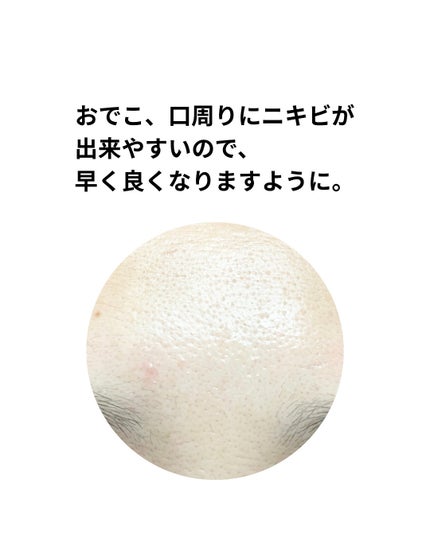 ダーマジェンシー ゼロカ81 セラム/DERMAGENCY/美容液を使ったクチコミ(3枚目)