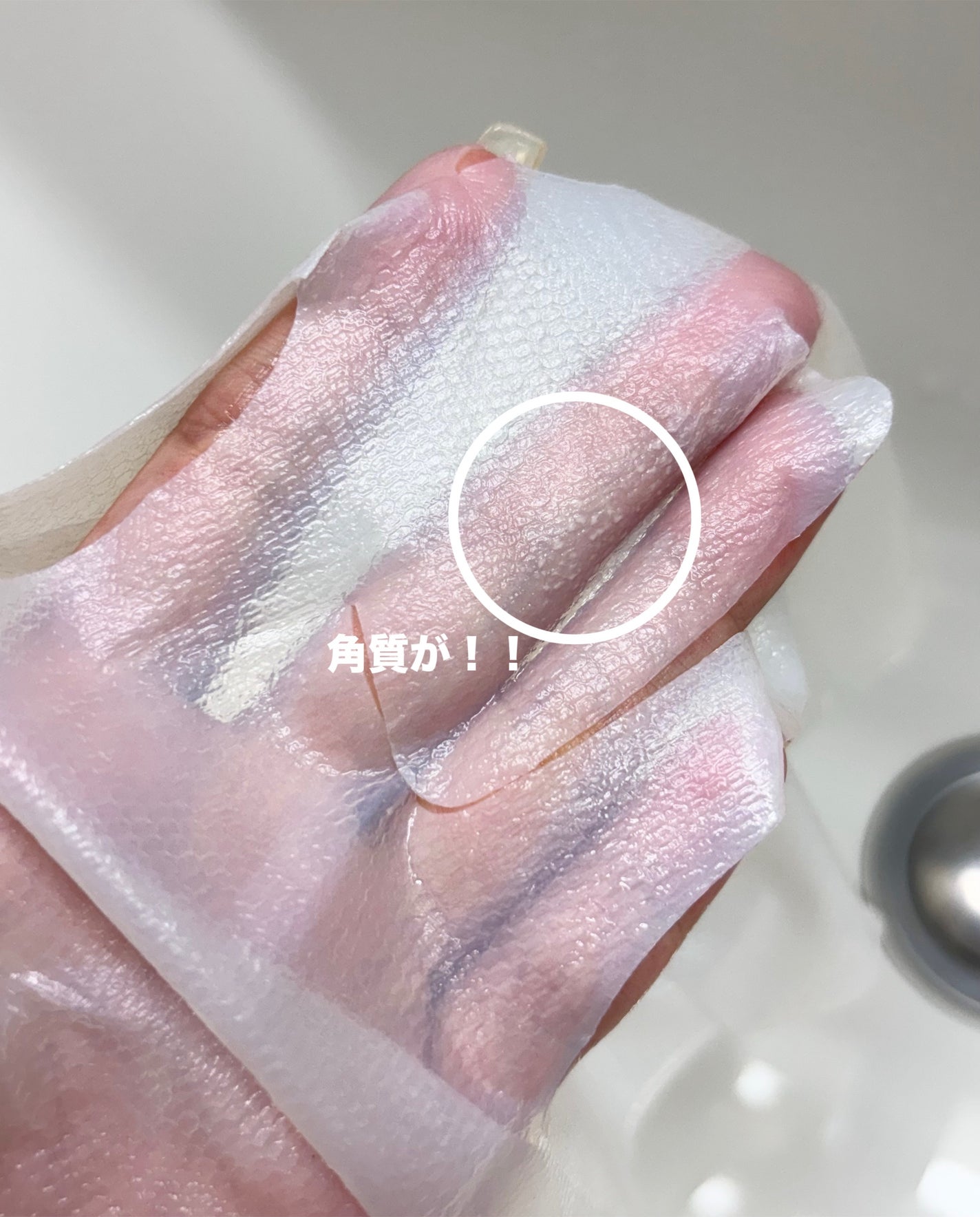 トラブルパッチマスク/EIOM/その他スキンケアを使ったクチコミ(4枚目)