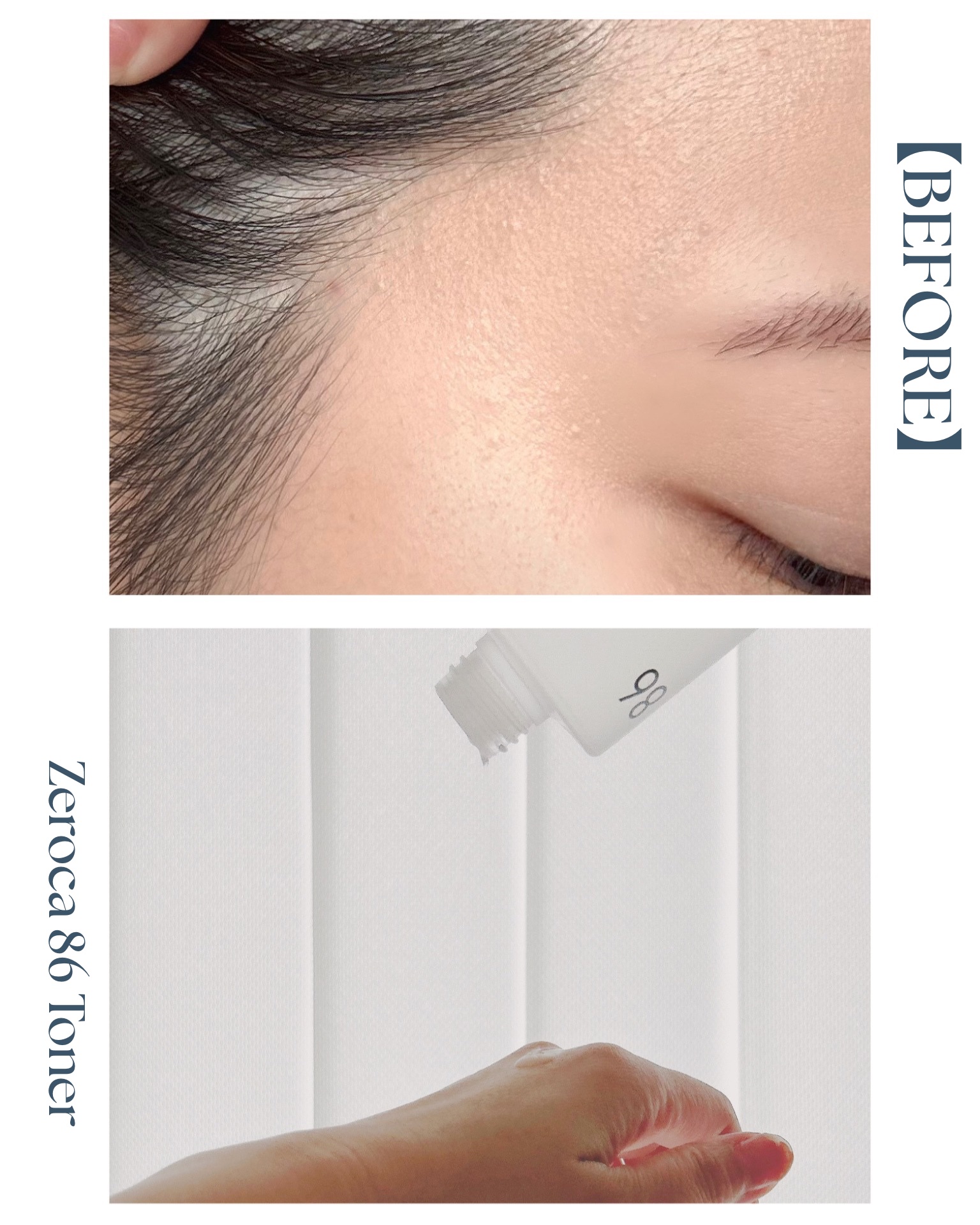 ダーマジェンシー ゼロカ86 トナー/DERMAGENCY/化粧水を使ったクチコミ（3枚目）