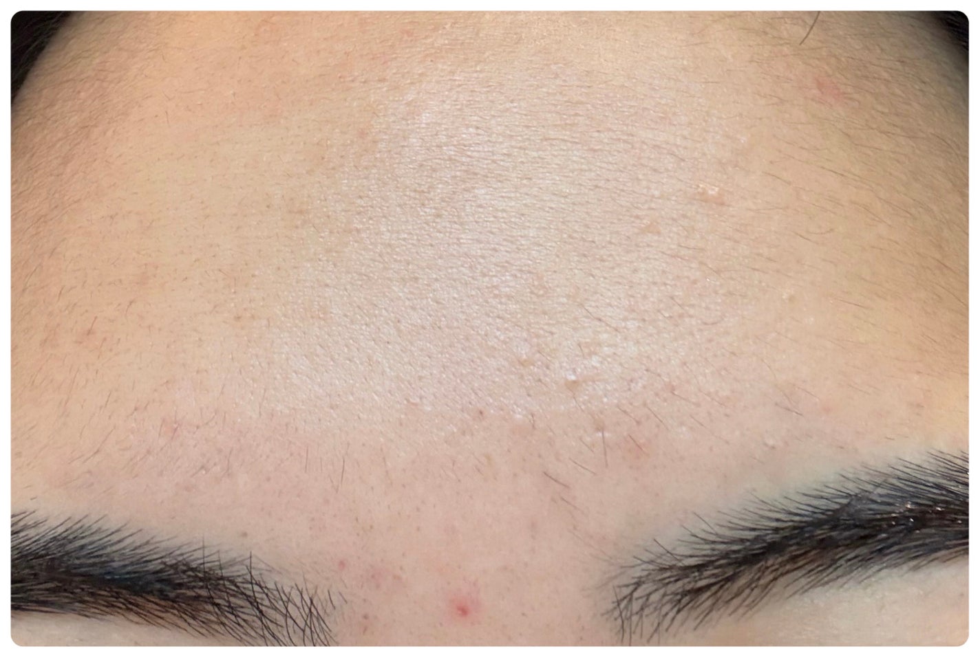 ごめんね素肌 キニナルマスク/クリアターン/シートマスク・パックを使ったクチコミ(3枚目)