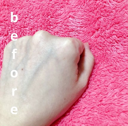 ダーマジェンシー ゼロカ81 セラム/DERMAGENCY/美容液を使ったクチコミ(3枚目)