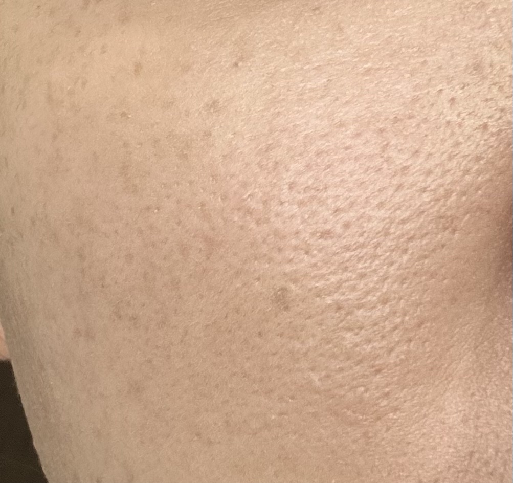 マイファンスィー モイスチャー ファンデーション 013 ピンクオークル(標準色)/Koh Gen Do/クリーム・エマルジョンファンデーションを使ったクチコミ（2枚目）