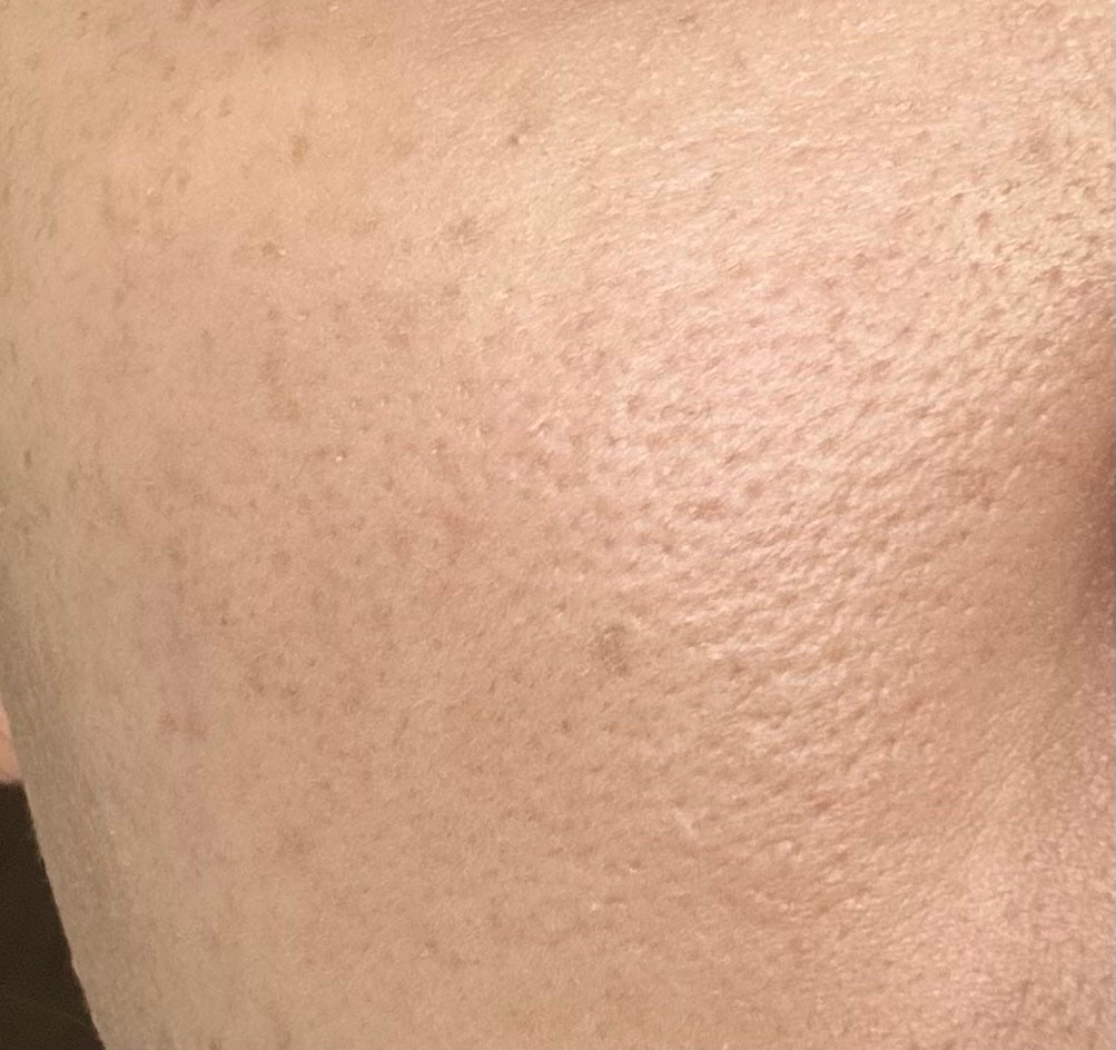 モイスチャー フィット コンシーラー/Koh Gen Do/リキッドコンシーラーを使ったクチコミ(2枚目)