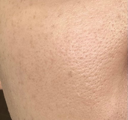 モイスチャー フィット コンシーラー/Koh Gen Do/リキッドコンシーラーを使ったクチコミ(2枚目)