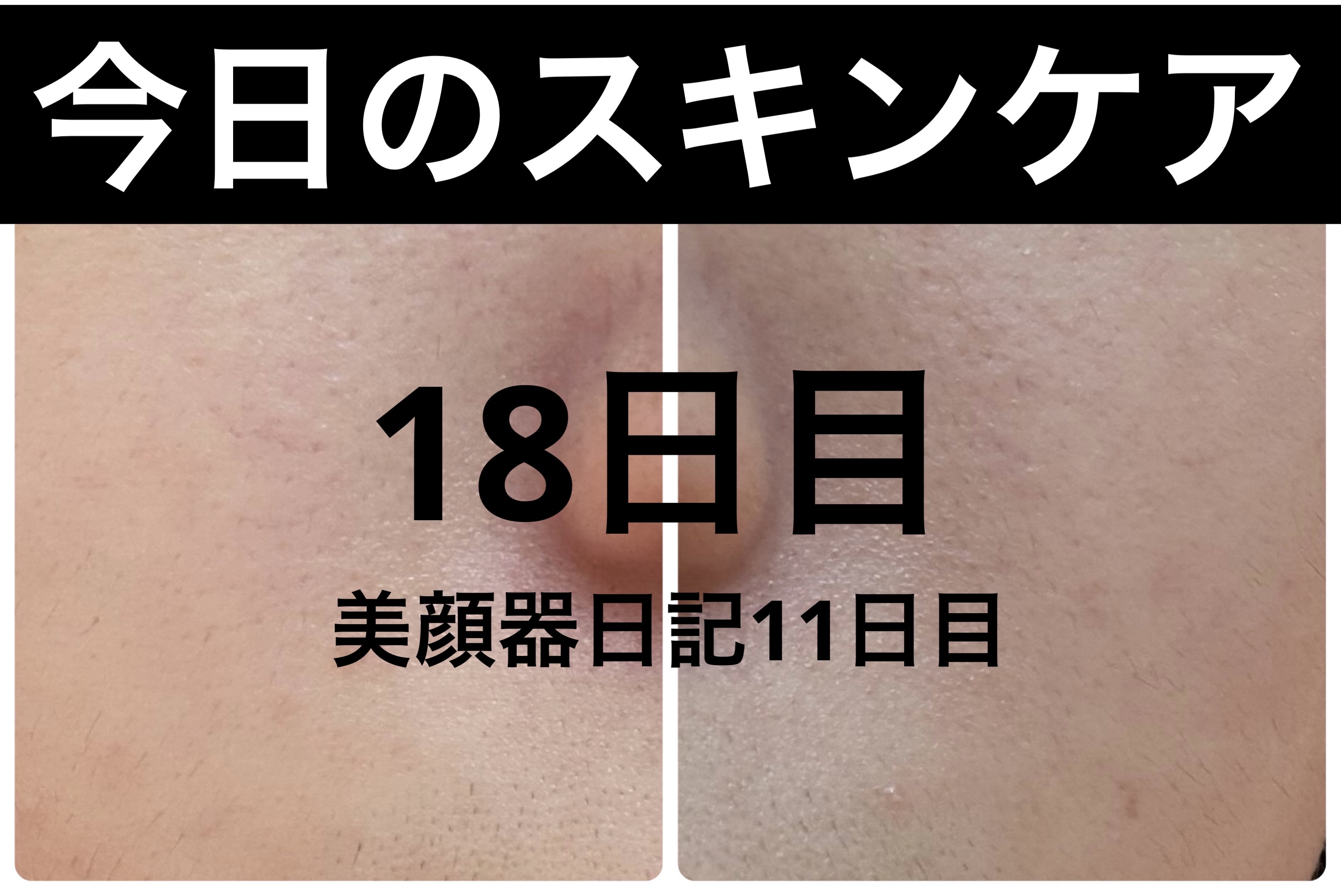 エターナルアイクリーム/リュバンブラン/アイケア・アイクリームを使ったクチコミ（1枚目）