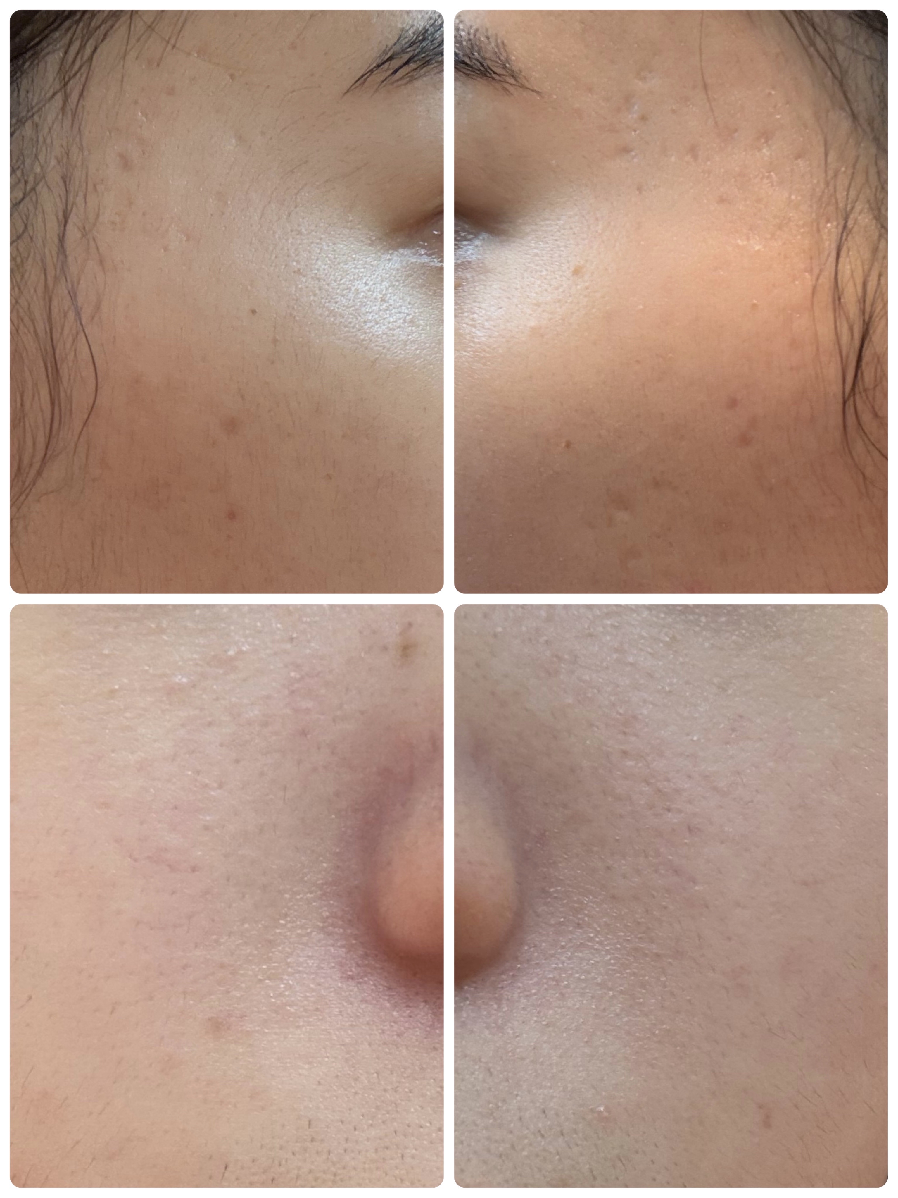 エターナルアイクリーム/リュバンブラン/アイケア・アイクリームを使ったクチコミ（2枚目）