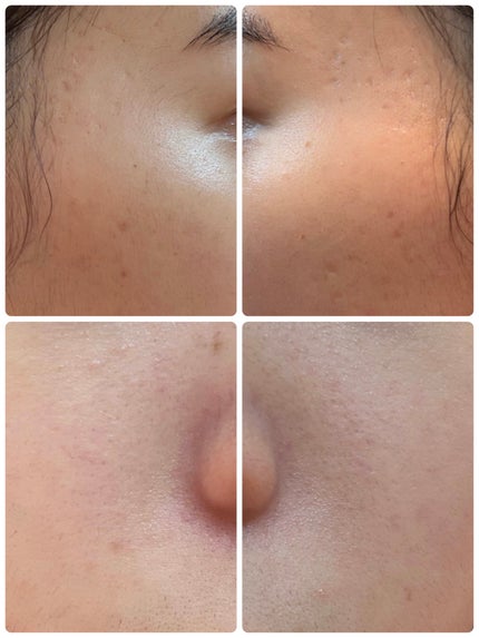 エターナルアイクリーム 8g/リュバンブラン/アイケア・アイクリームを使ったクチコミ(2枚目)