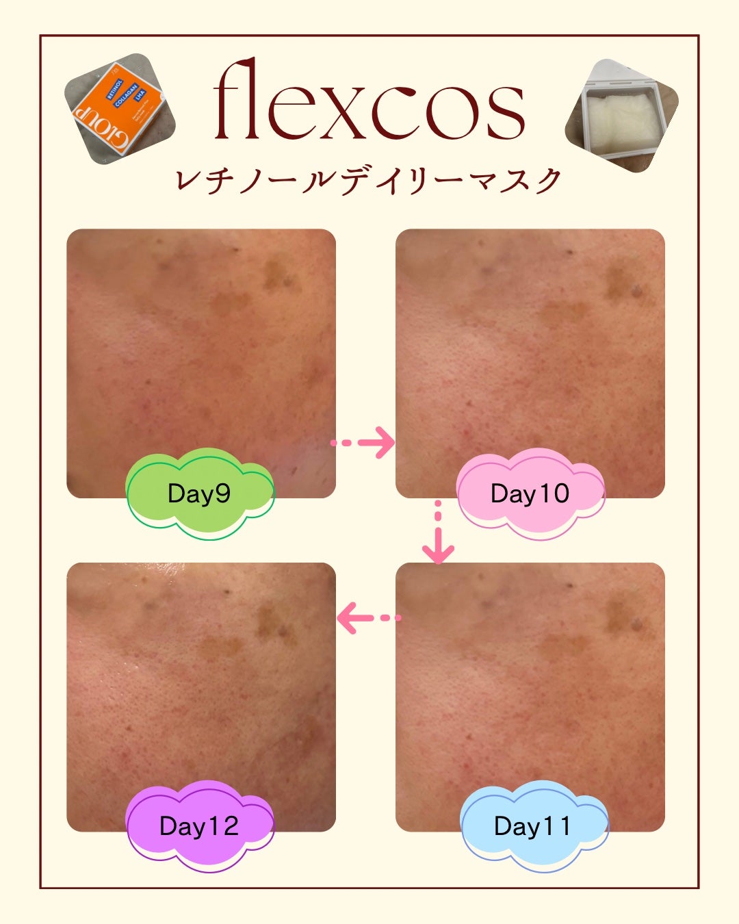 GLOUP DERMA RETINOL PLUS DAILY MASK/flexcos/シートマスク・パックを使ったクチコミ(7枚目)