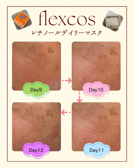 GLOUP DERMA RETINOL PLUS DAILY MASK/flexcos/シートマスク・パックを使ったクチコミ(7枚目)