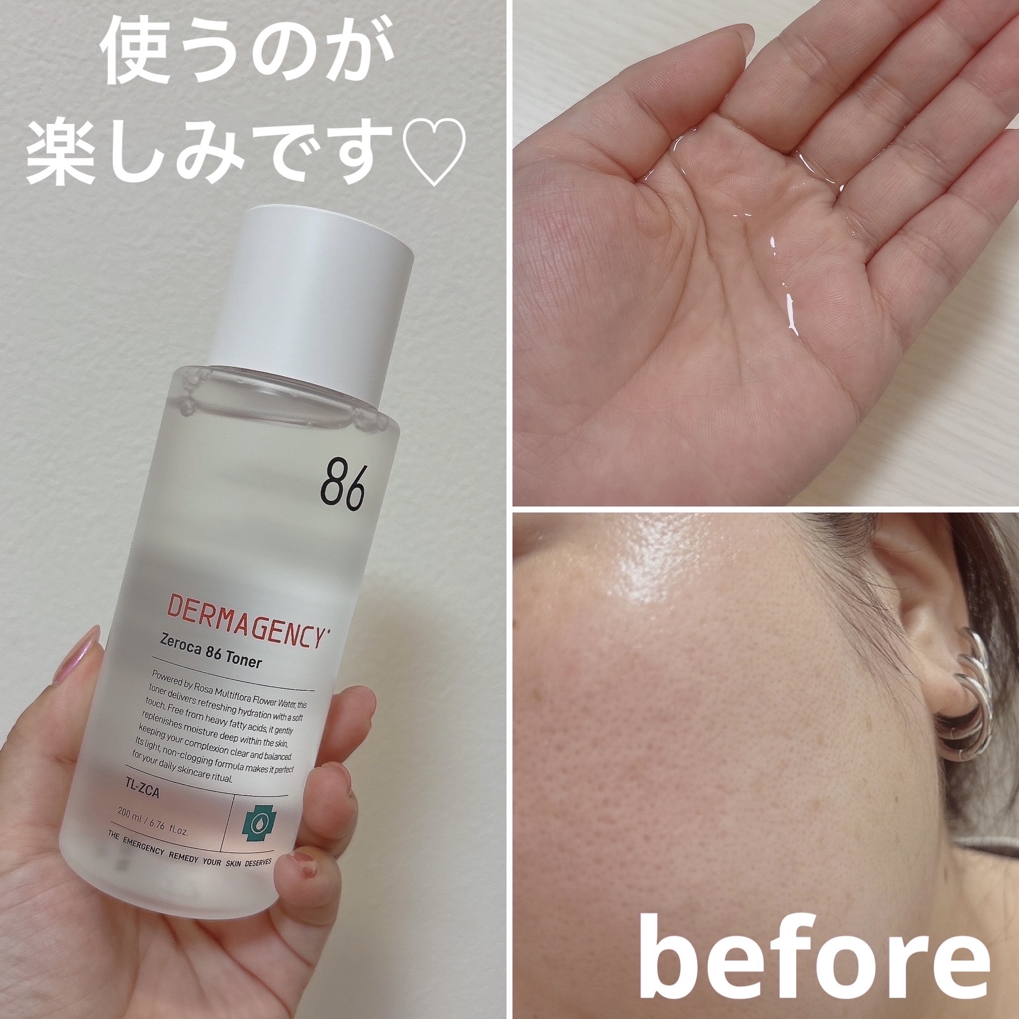 ダーマジェンシー ゼロカ86 トナー/DERMAGENCY/化粧水を使ったクチコミ（2枚目）
