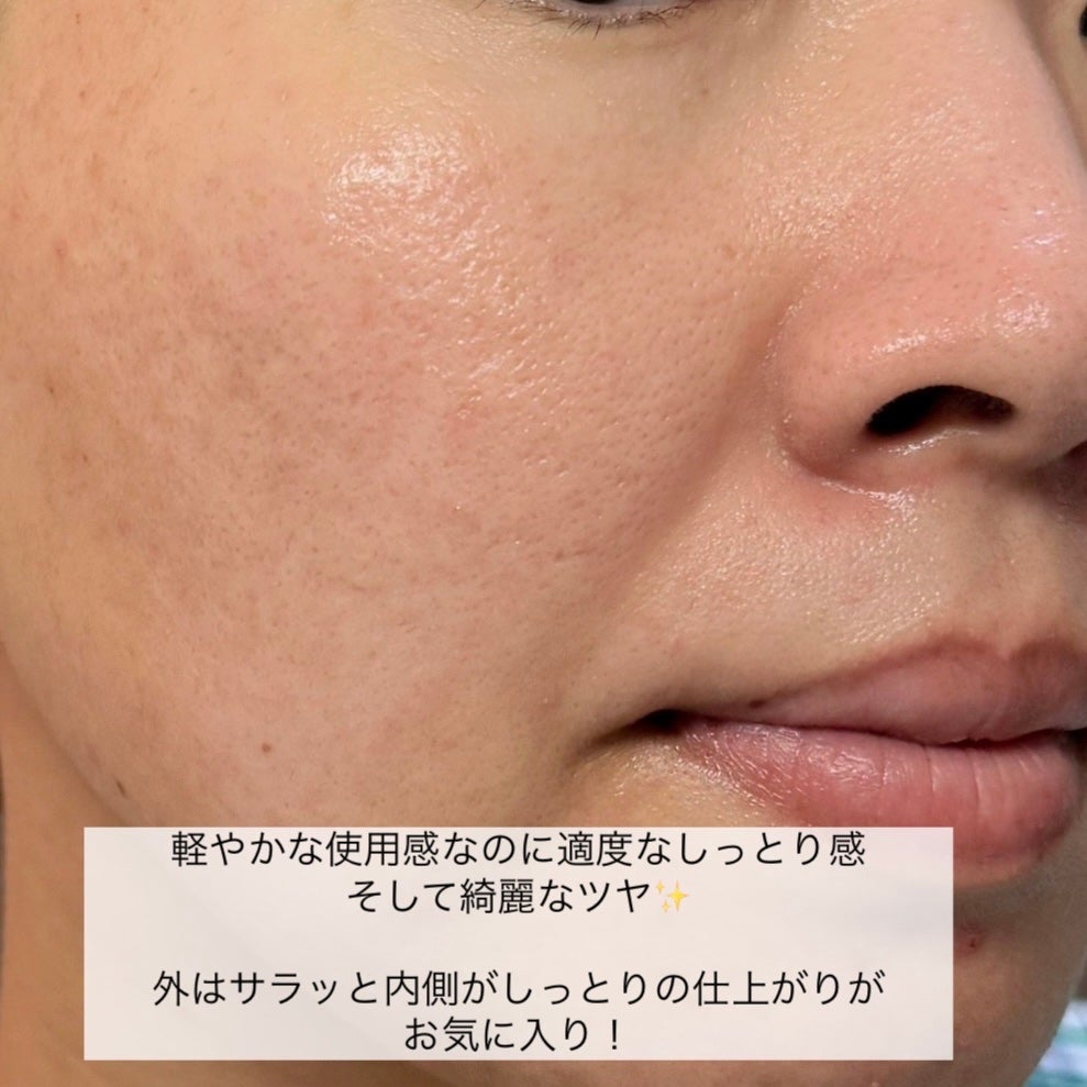 Skin Barrier Calming Lotion/Ongredients/乳液を使ったクチコミ(4枚目)