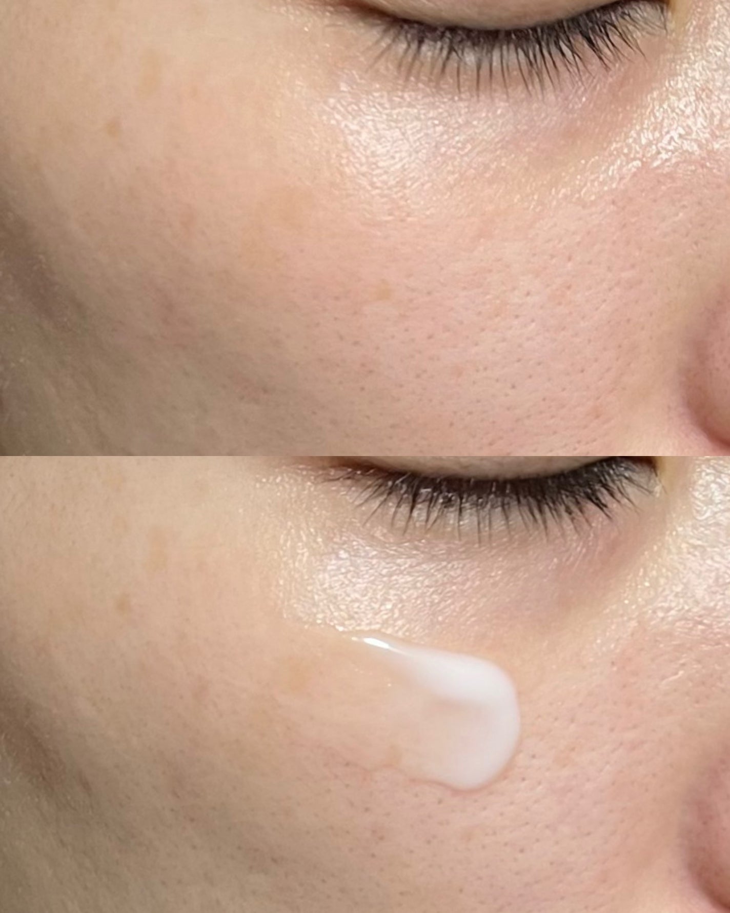 ダーマジェンシー ゼロカ81 クリーム/DERMAGENCY/フェイスクリームを使ったクチコミ(3枚目)