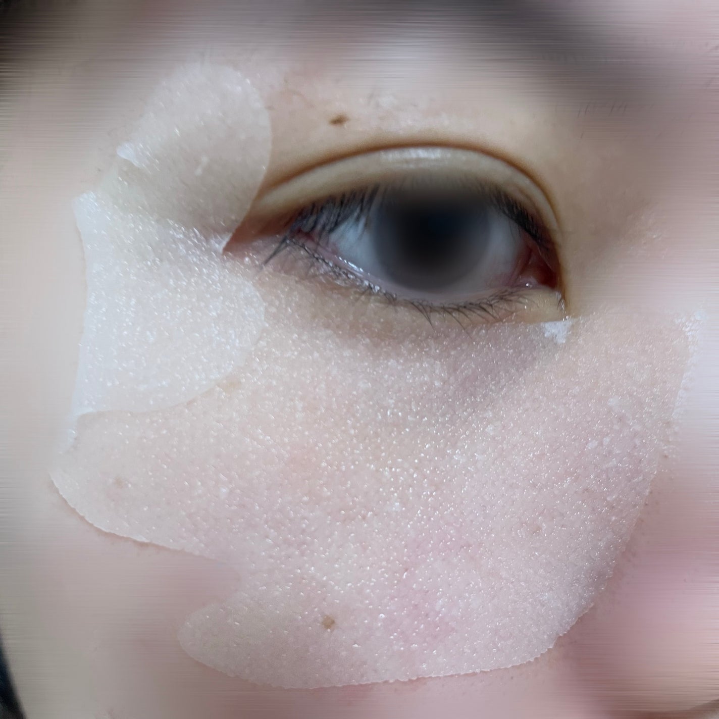 ごめんね素肌 スポットケアマスク/クリアターン/シートマスク・パックを使ったクチコミ(5枚目)